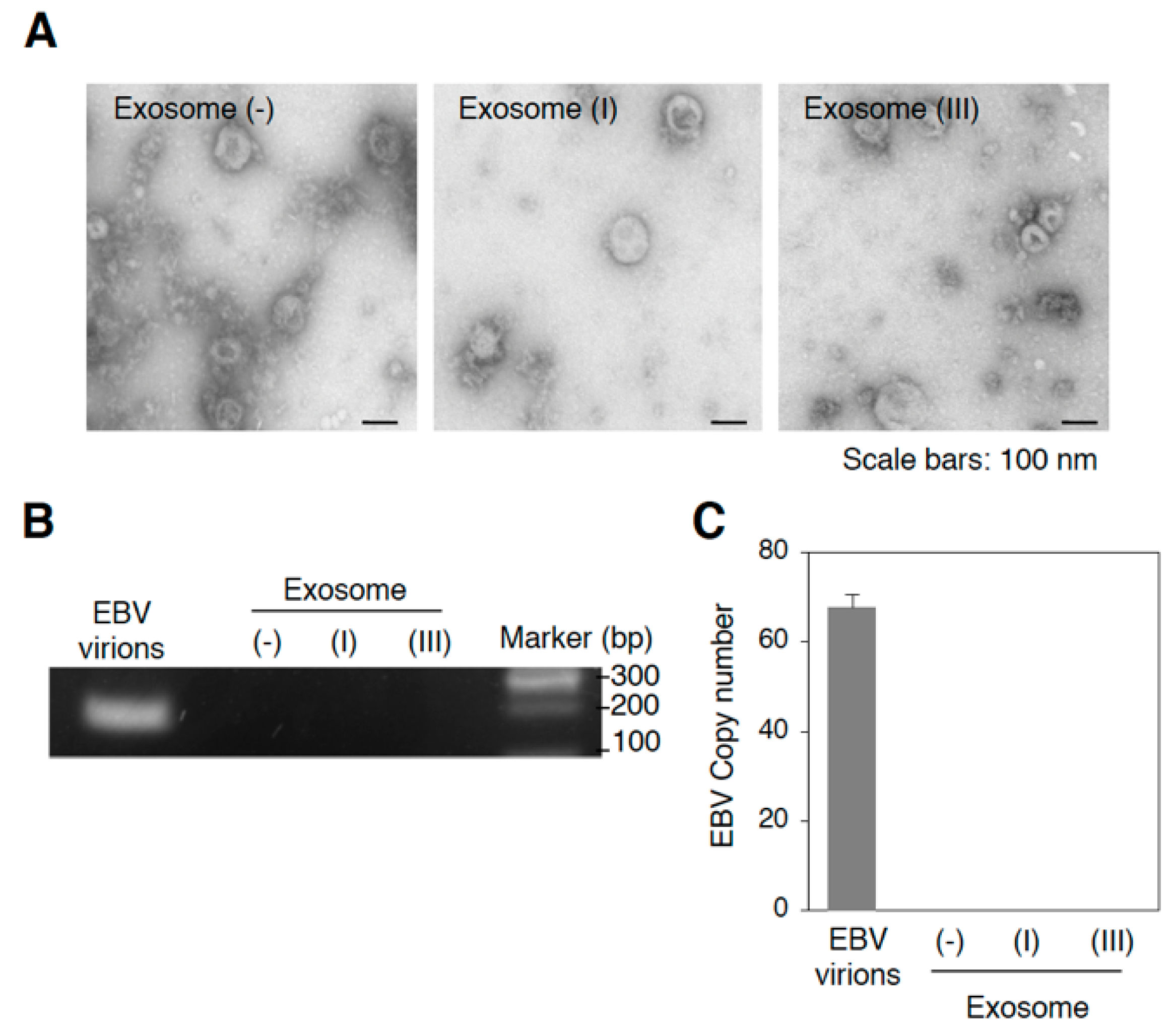 Cancers Free Full-Text | Infection of Epstein–Barr Virus in Type III Latency Modulates Biogenesis of Exosomes and the Expression Profile of Exosomal miRNAs in Lymphoma Mutu Cell Lines