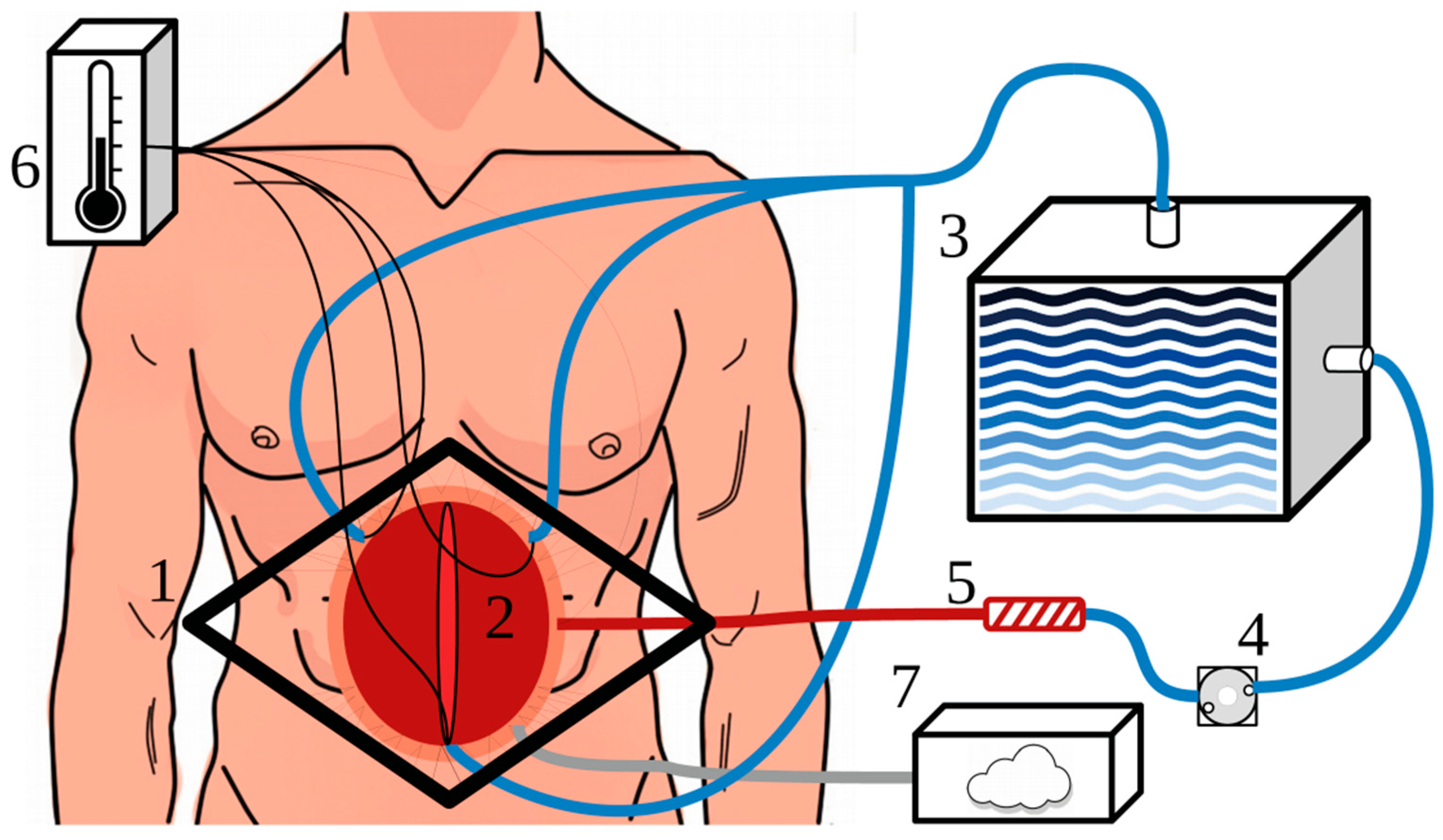 blood-test-could-help-detect-ovarian-cancer-in-primary-care-onmedica