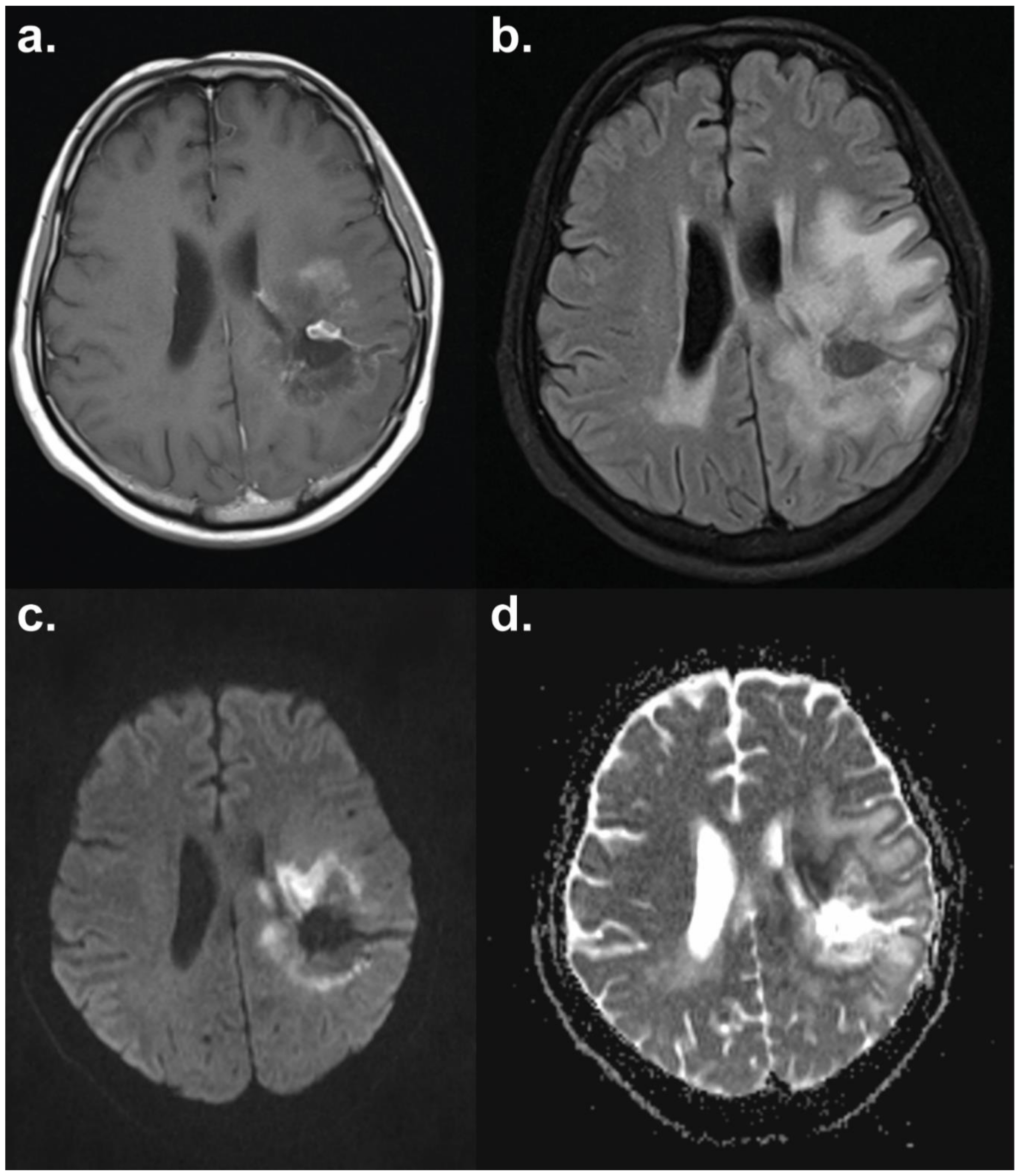 Cancers 11 00131 g003