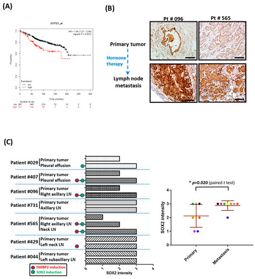 Cancers | Free Full-Text | TARBP2-Enhanced Resistance during 