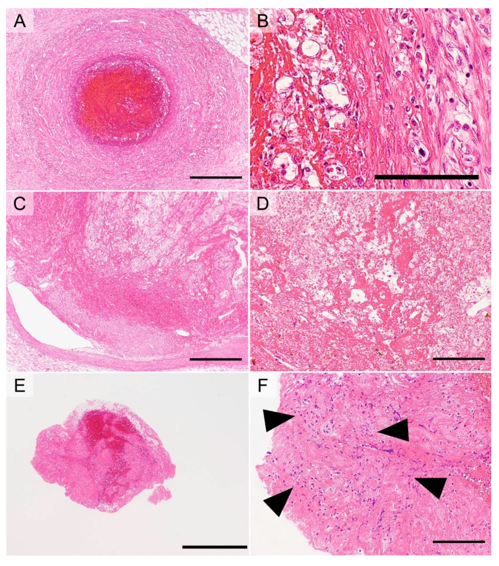 Cancers 11 00488 g005