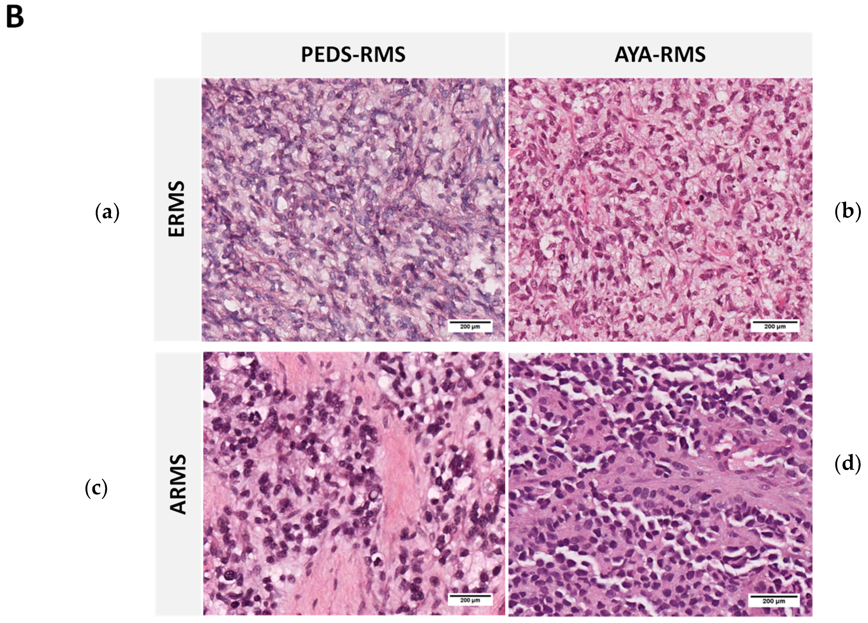 Cancers 11 01380 g001b
