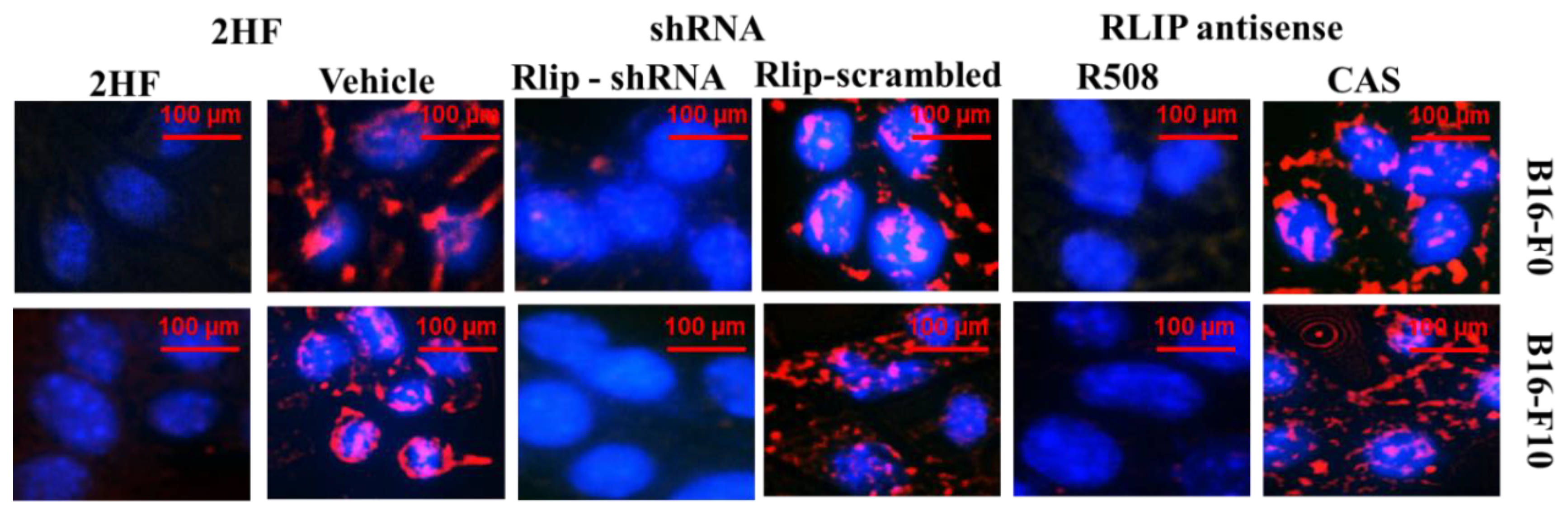 Cancers 11 01556 g0a1