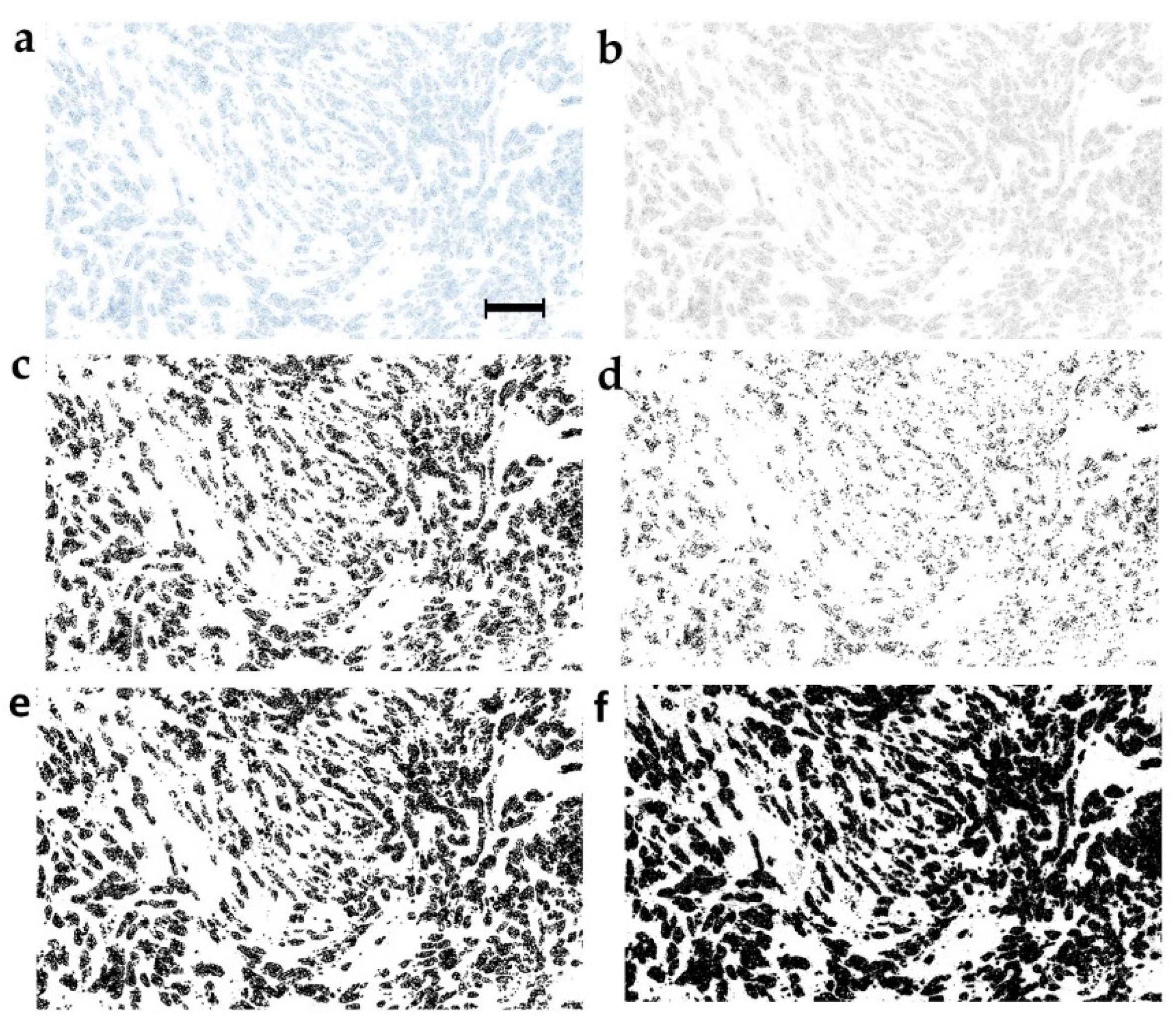 Cancers 11 01615 g001 Cancers 11 01615 g001