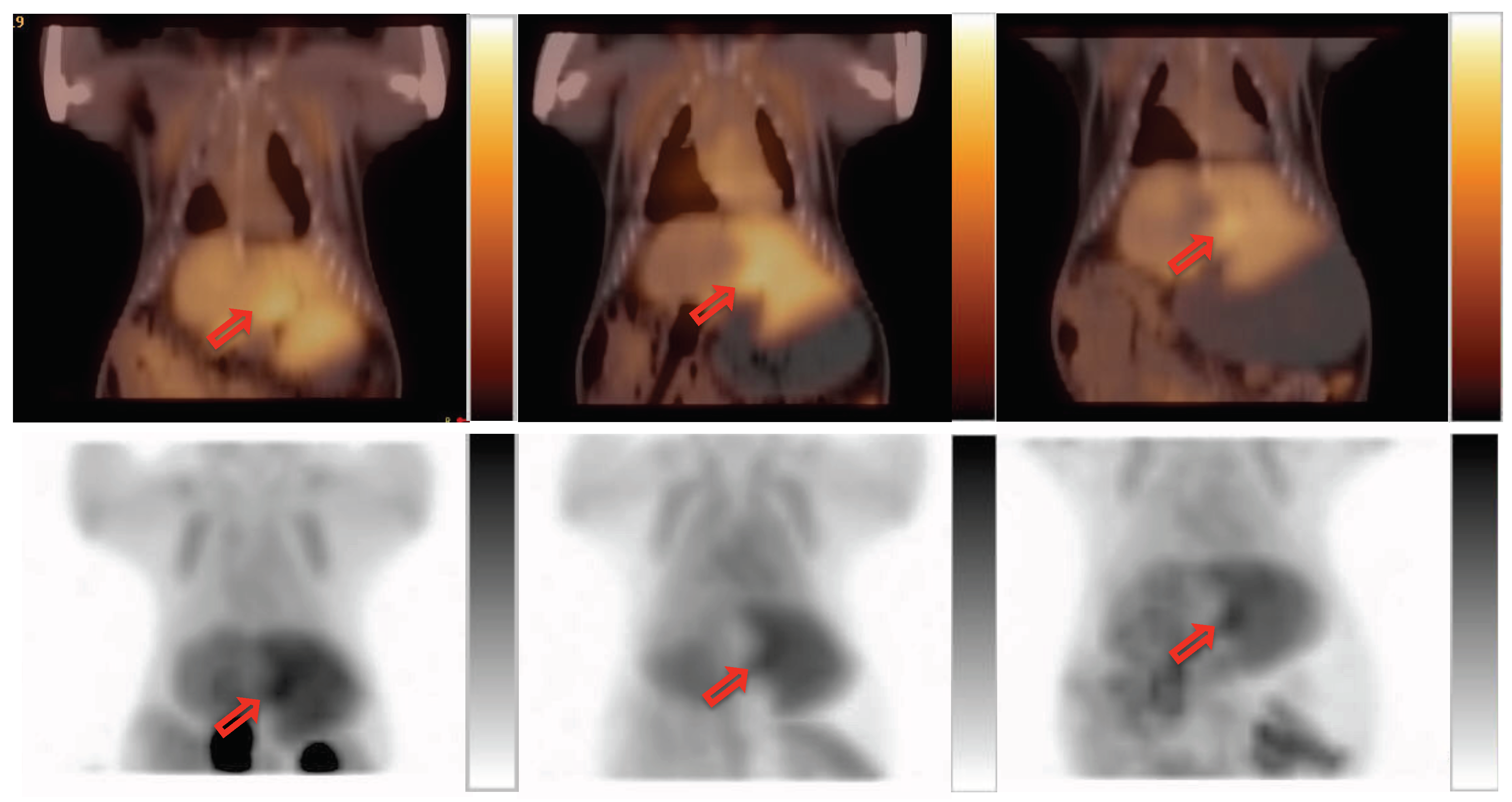 Cancers 11 01748 g006 Cancers 11 01748 g006