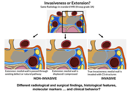 Cancers | Free Full-Text | Pituitary Adenomas And Invasiveness From ...