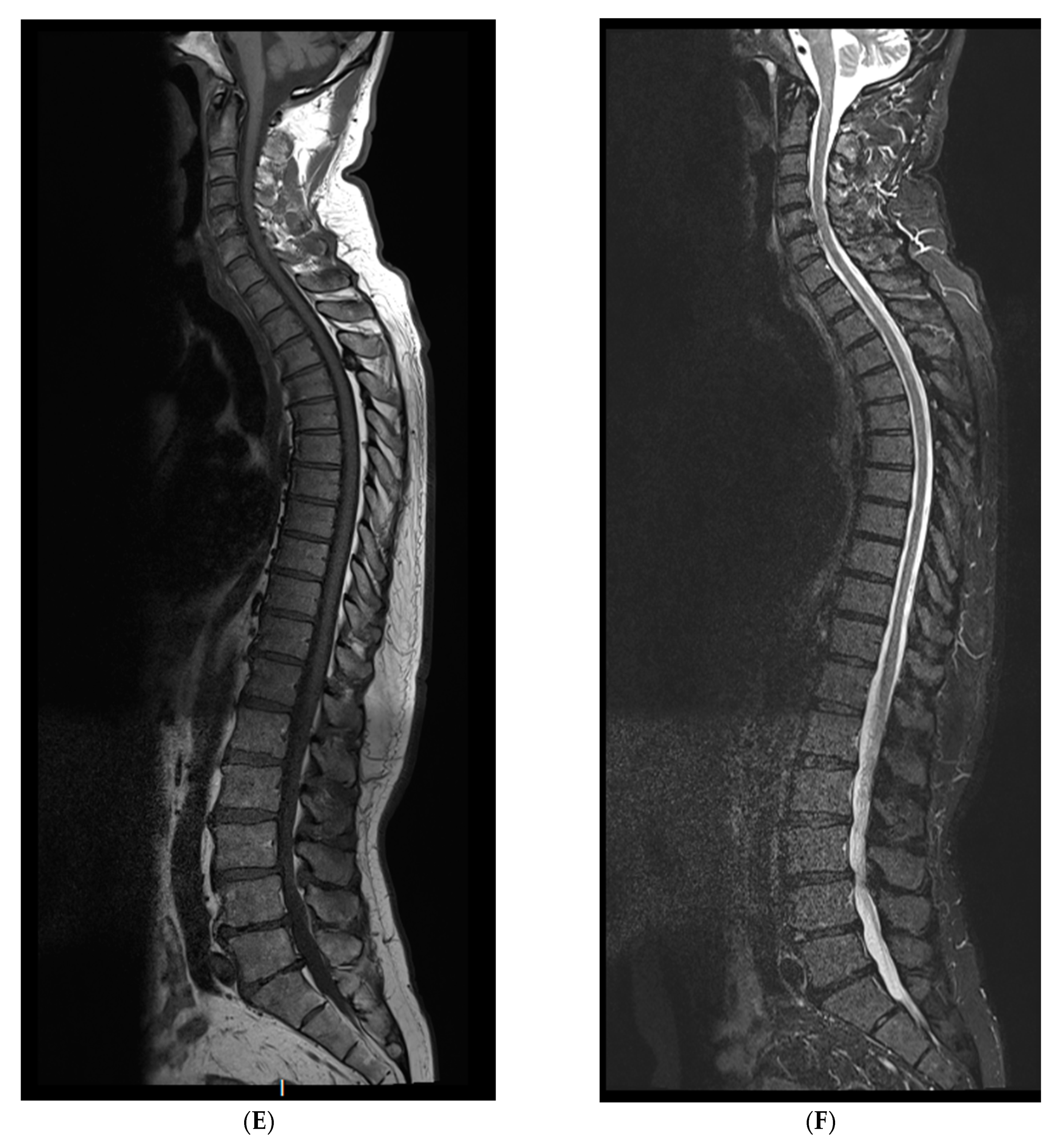 Cancers 12 00486 g001c Cancers 12 00486 g001c