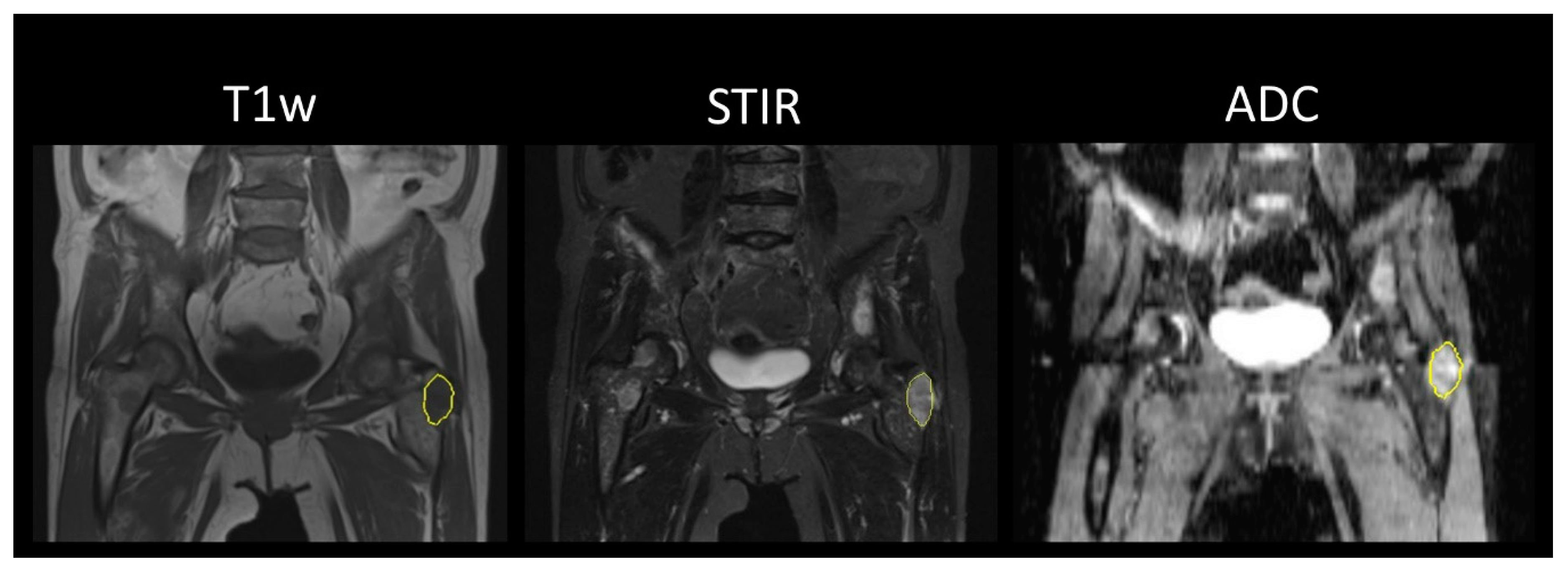 Cancers 12 00761 g001 Cancers 12 00761 g001