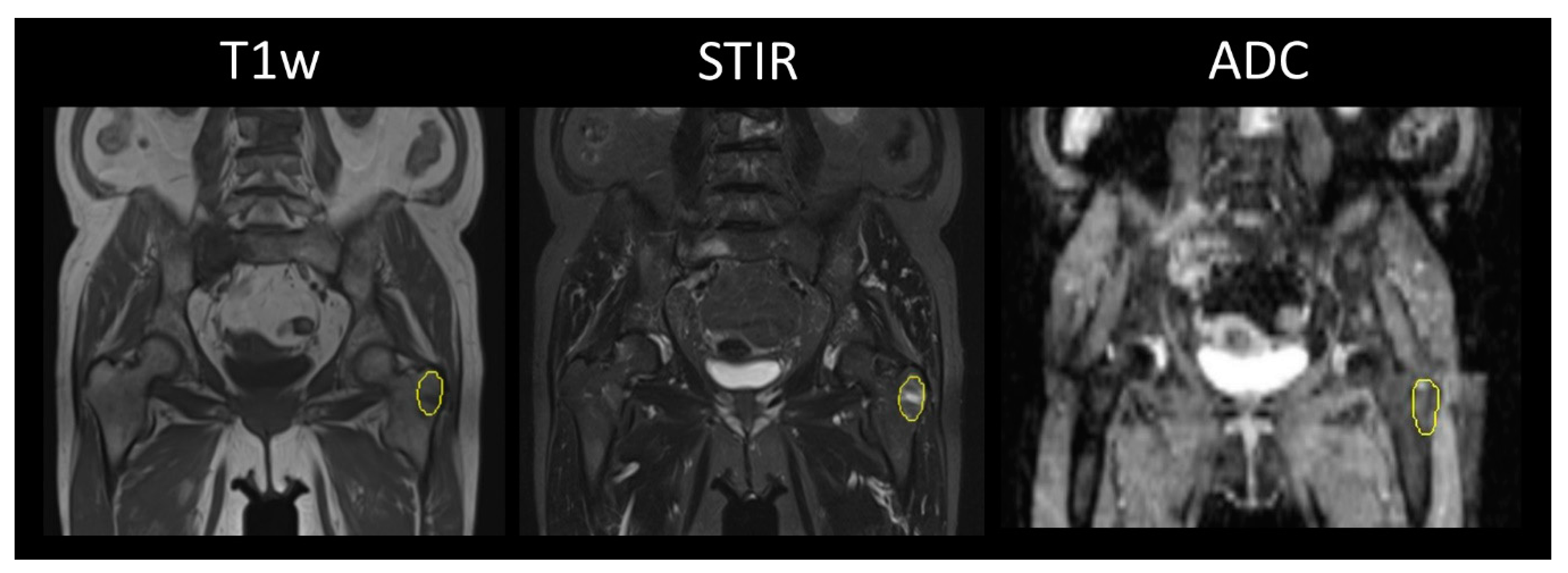 Cancers 12 00761 g002 Cancers 12 00761 g002