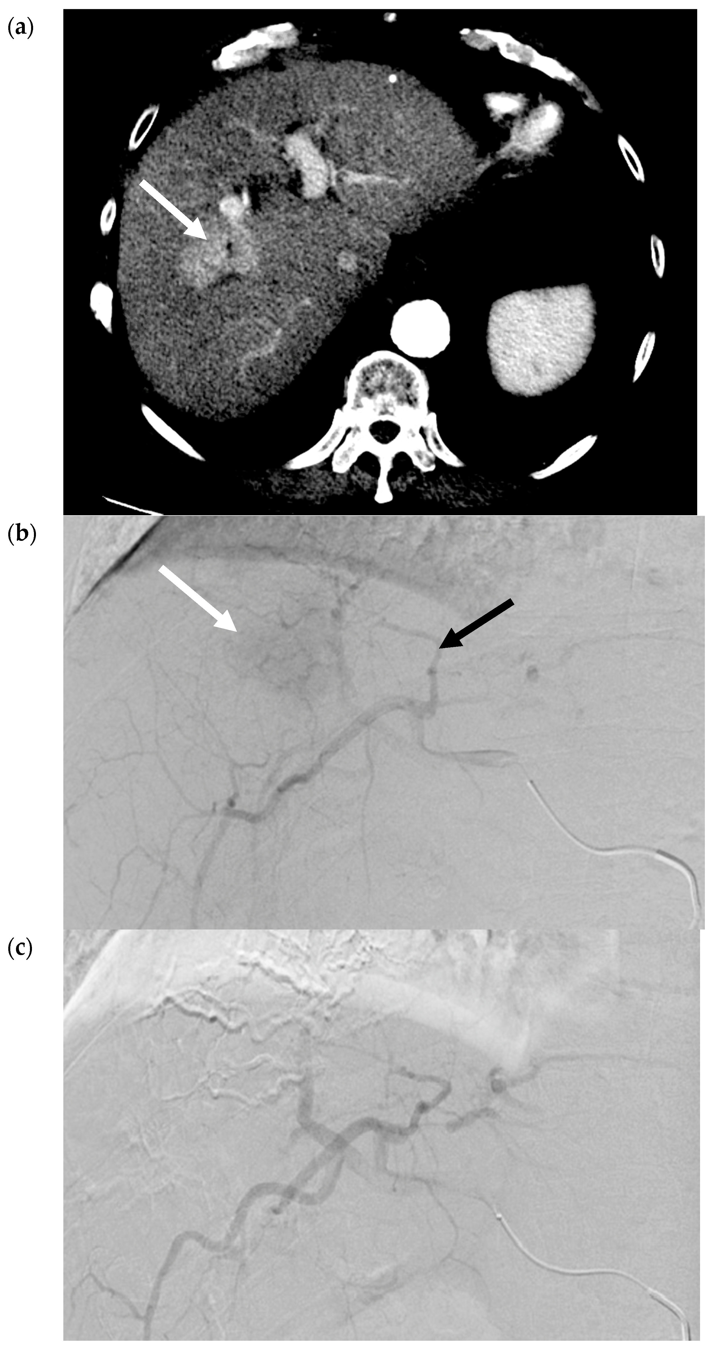 Cancers 12 00791 g002a Cancers 12 00791 g002a
