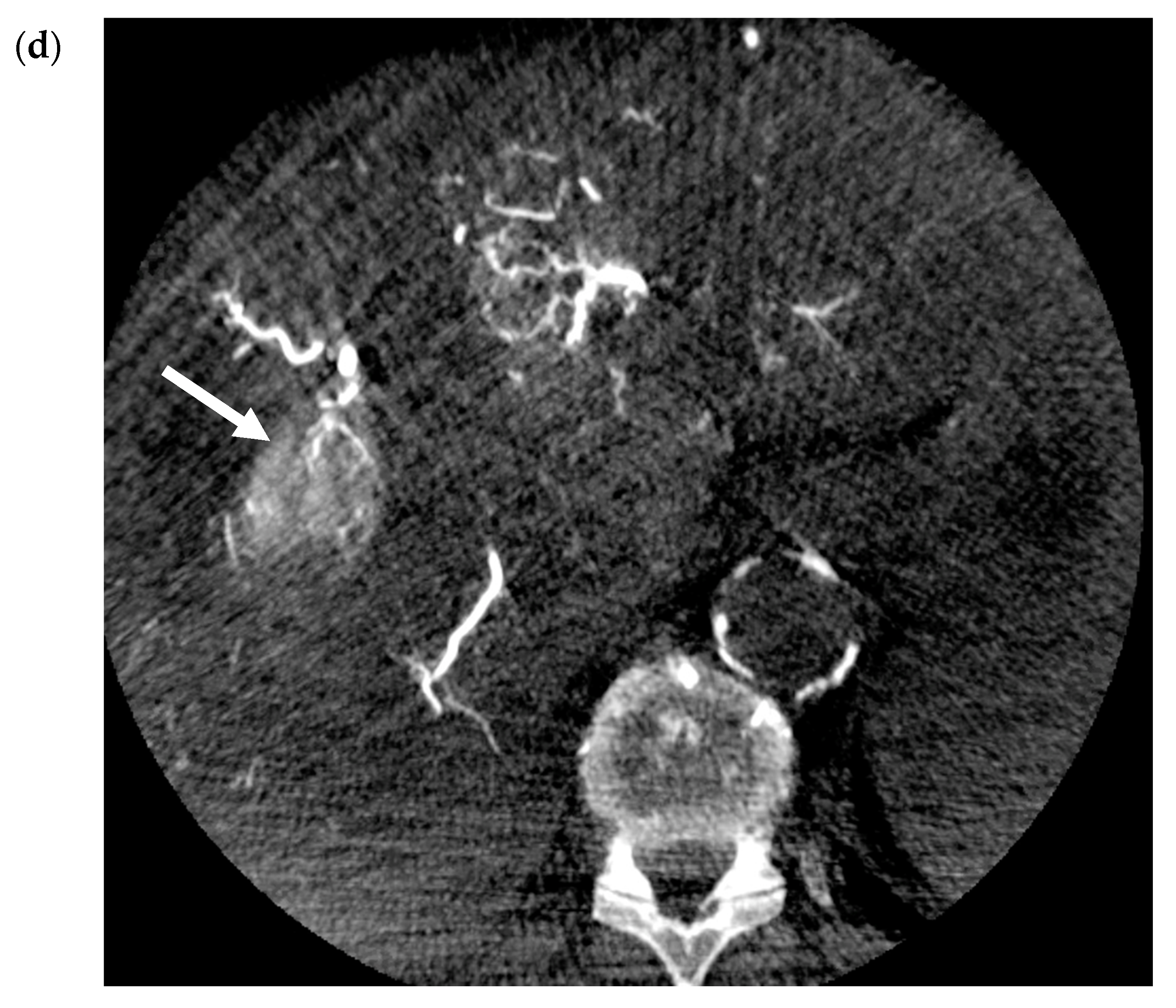 Cancers 12 00791 g002b Cancers 12 00791 g002b