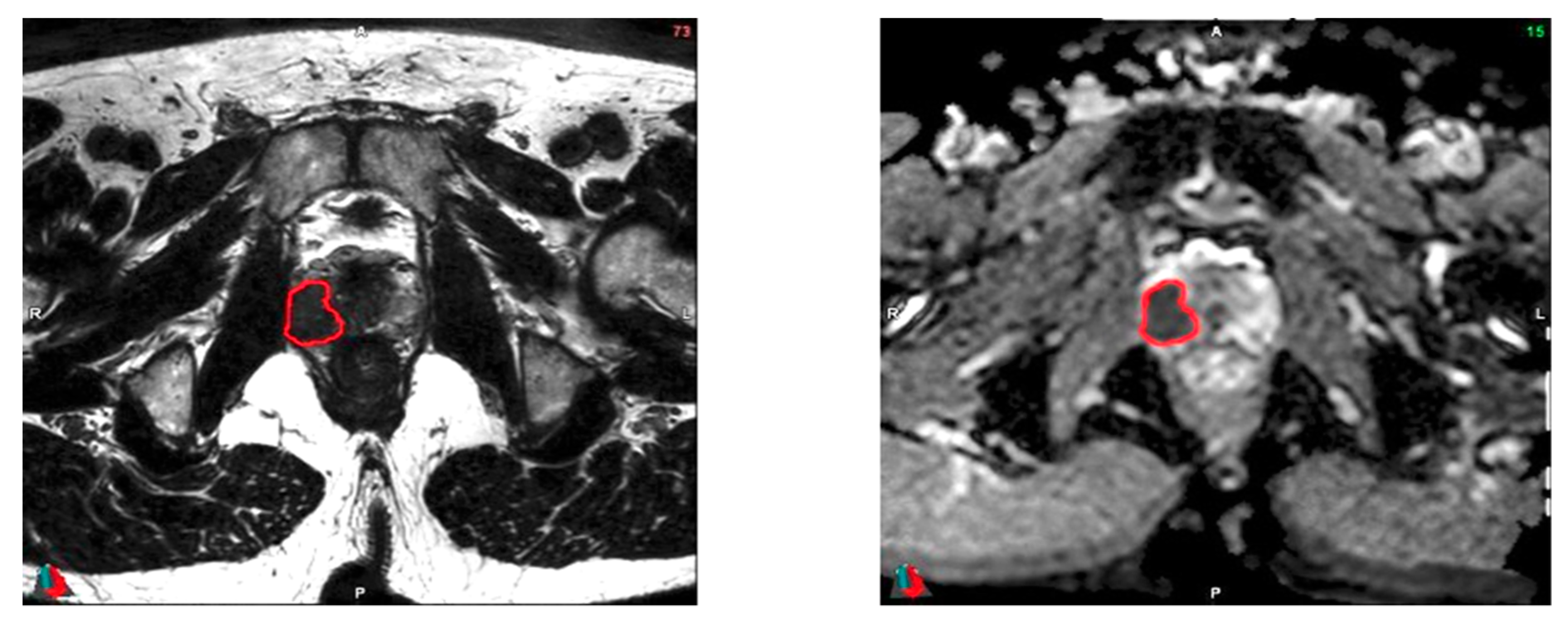 Cancers 12 00814 g002 Cancers 12 00814 g002