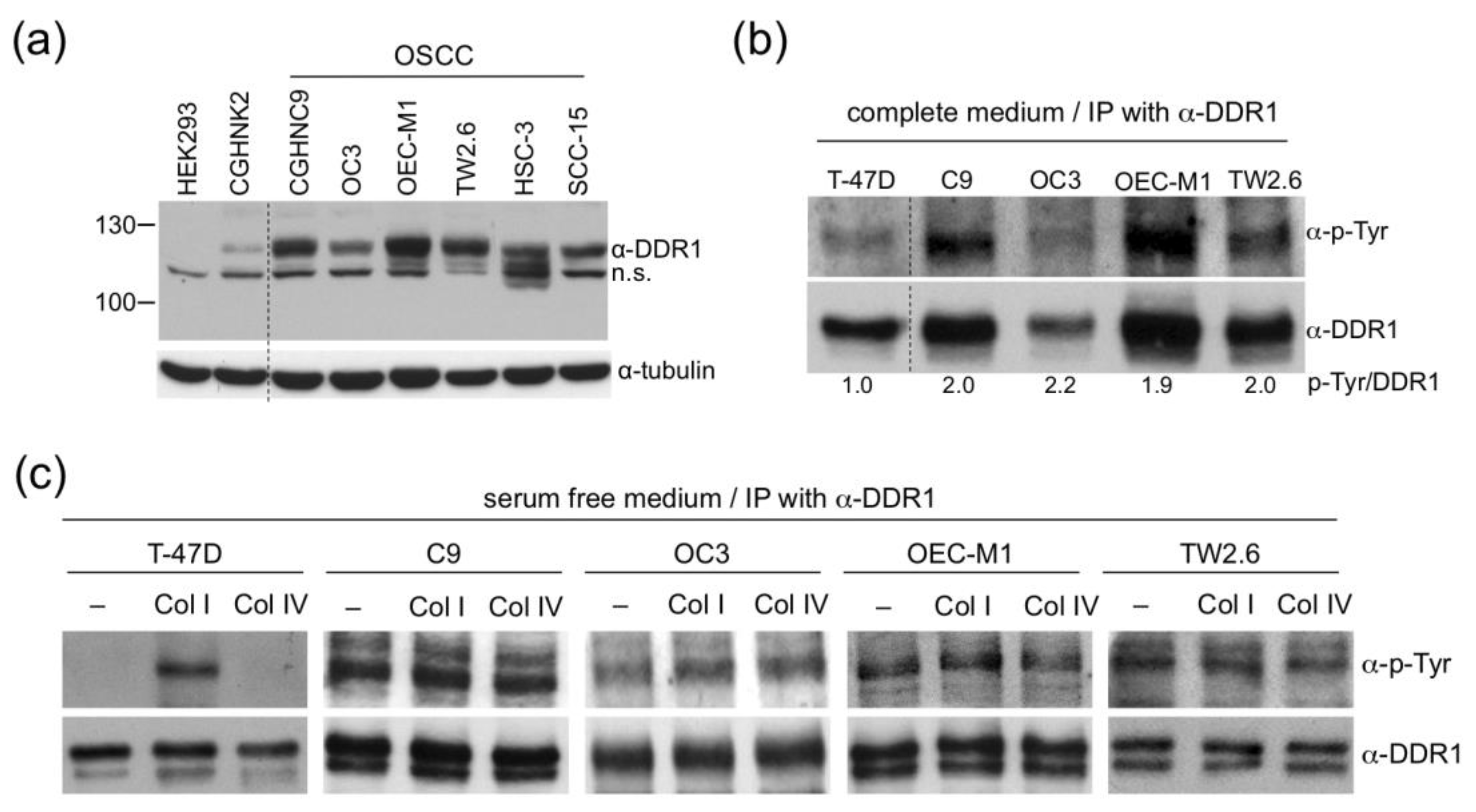 Cancers Free Full Text Discoidin Domain Receptor 1 Ddr1 Is Involved In Angiolymphatic Invasion In Oral Cancer Html