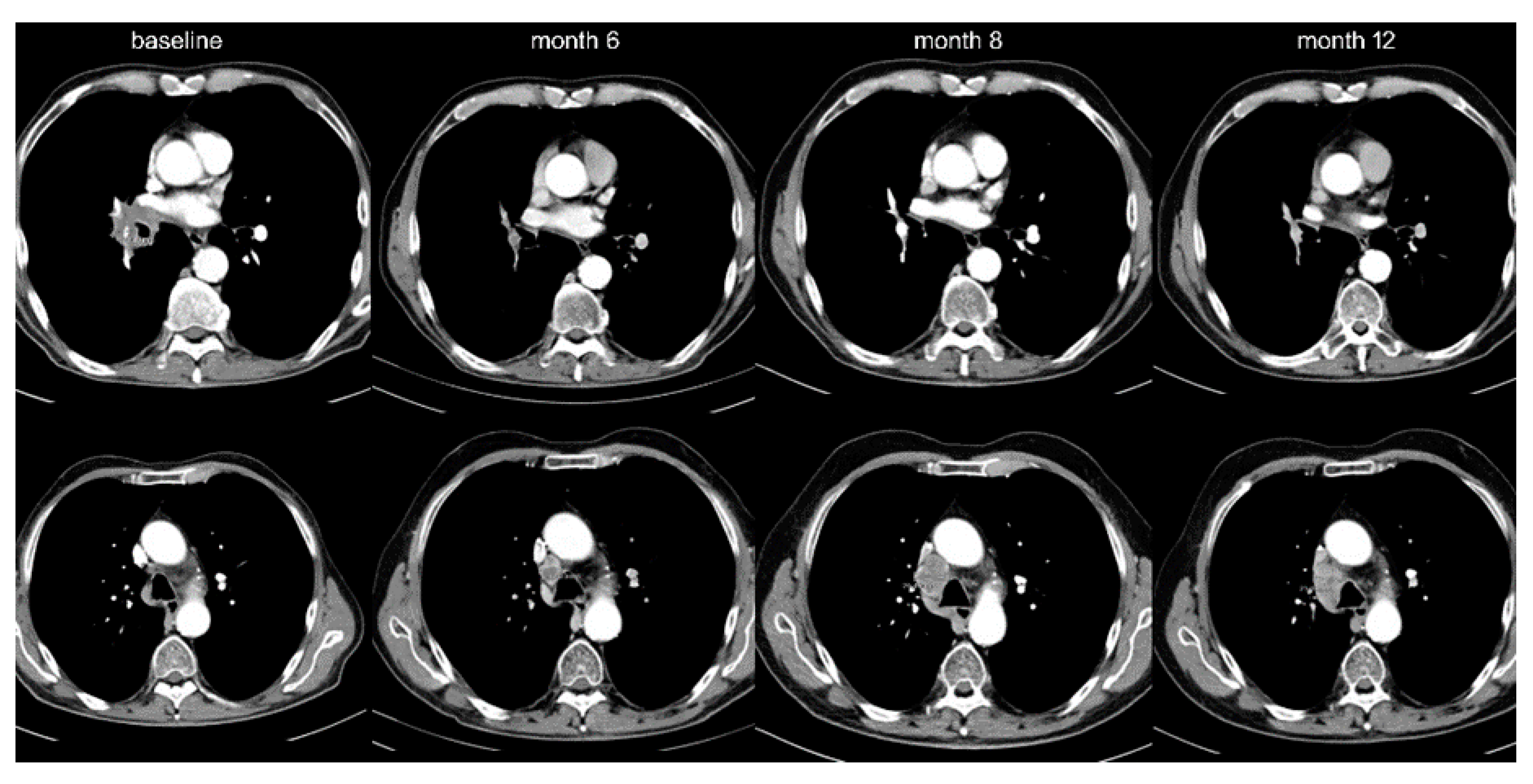 Cancers 12 01046 g002