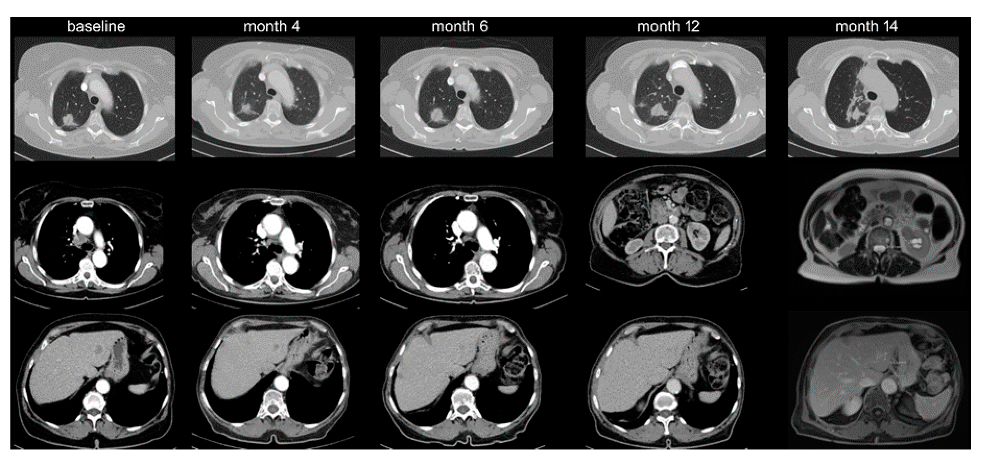 Cancers 12 01046 g003