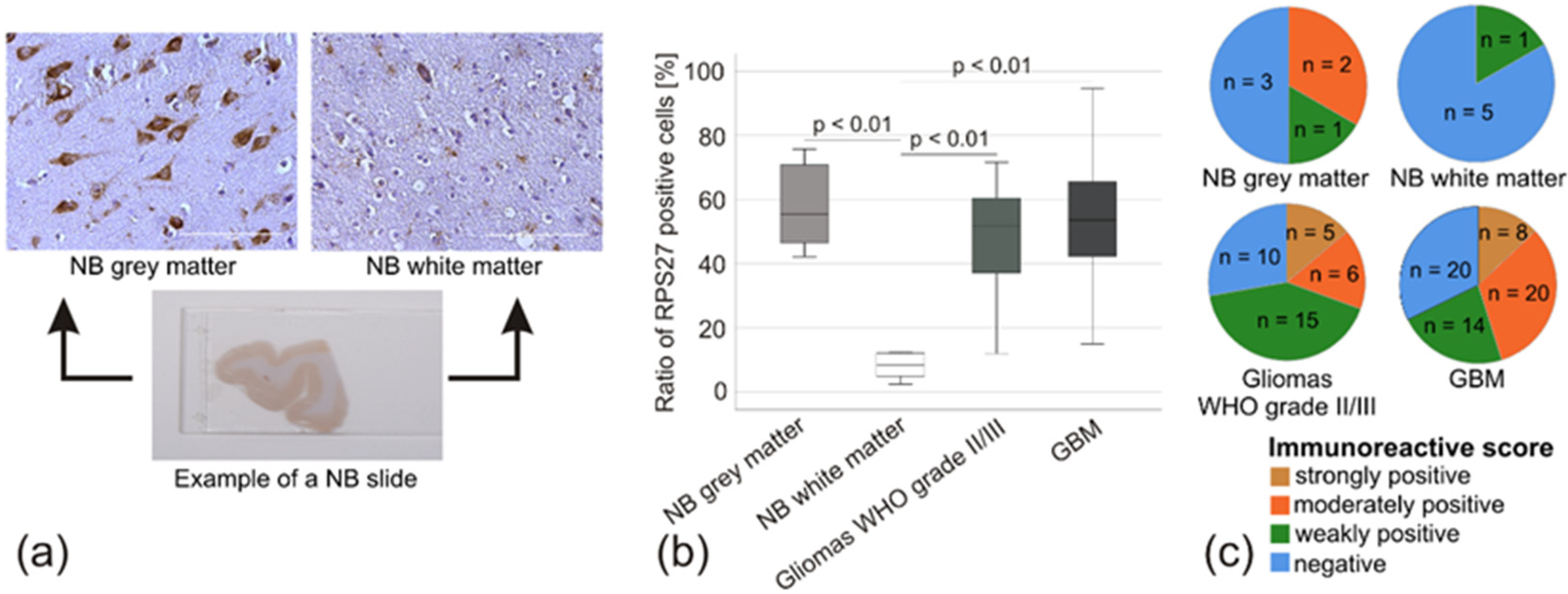 Cancers 12 01085 g005 Cancers 12 01085 g005