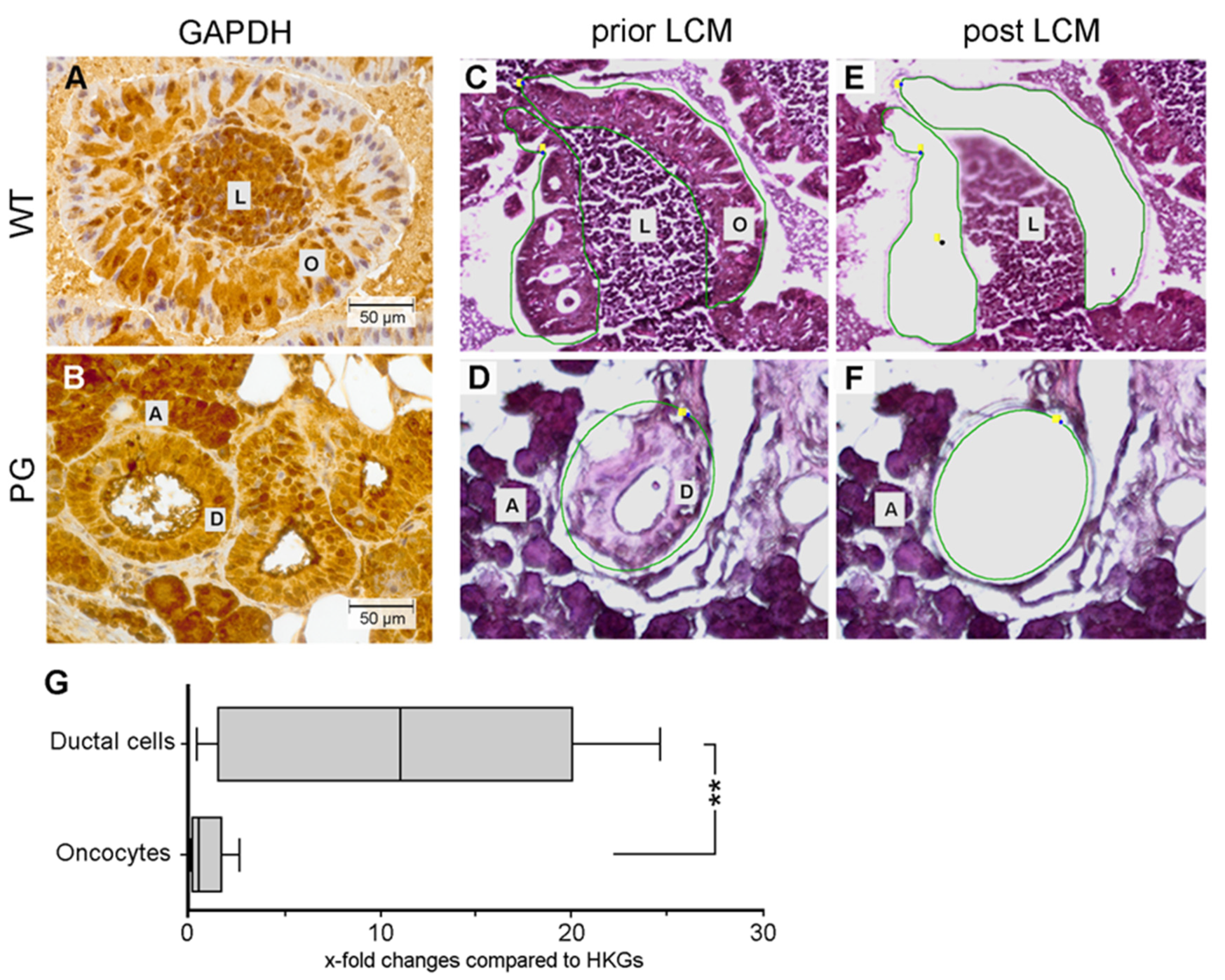 Cancers 12 01112 g004