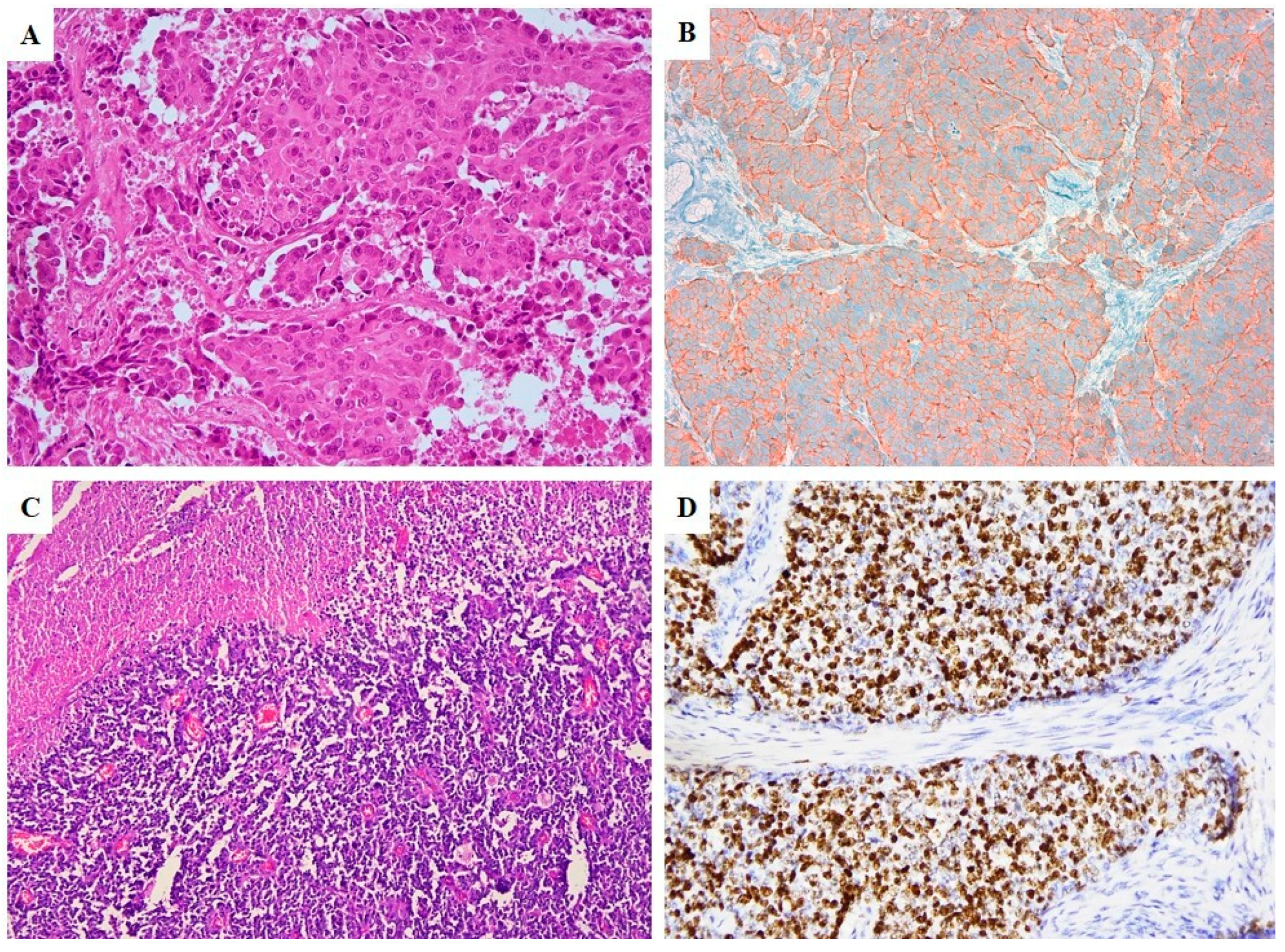 Cancers 12 01211 g002 Cancers 12 01211 g002