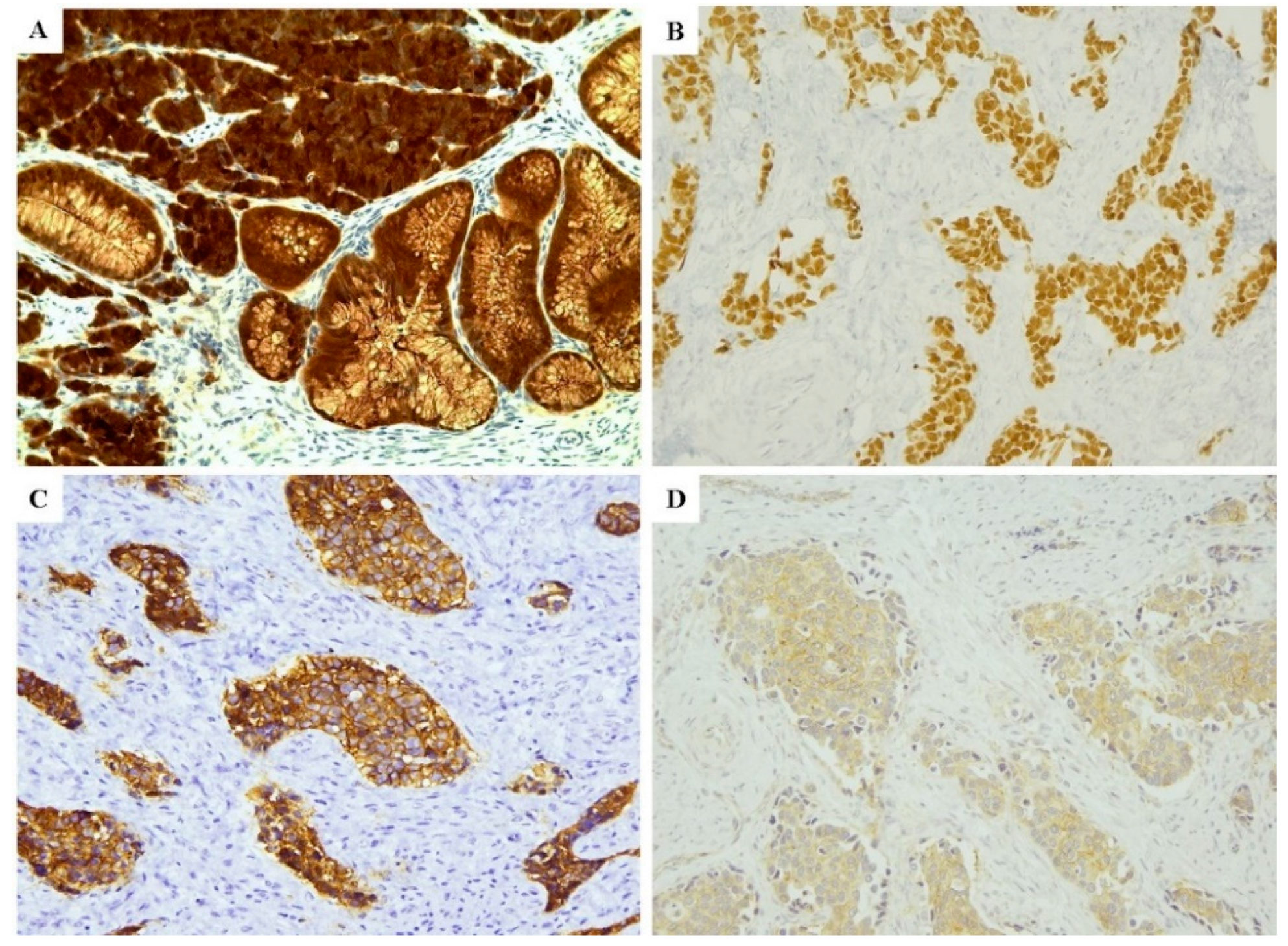 Cancers 12 01211 g003 Cancers 12 01211 g003