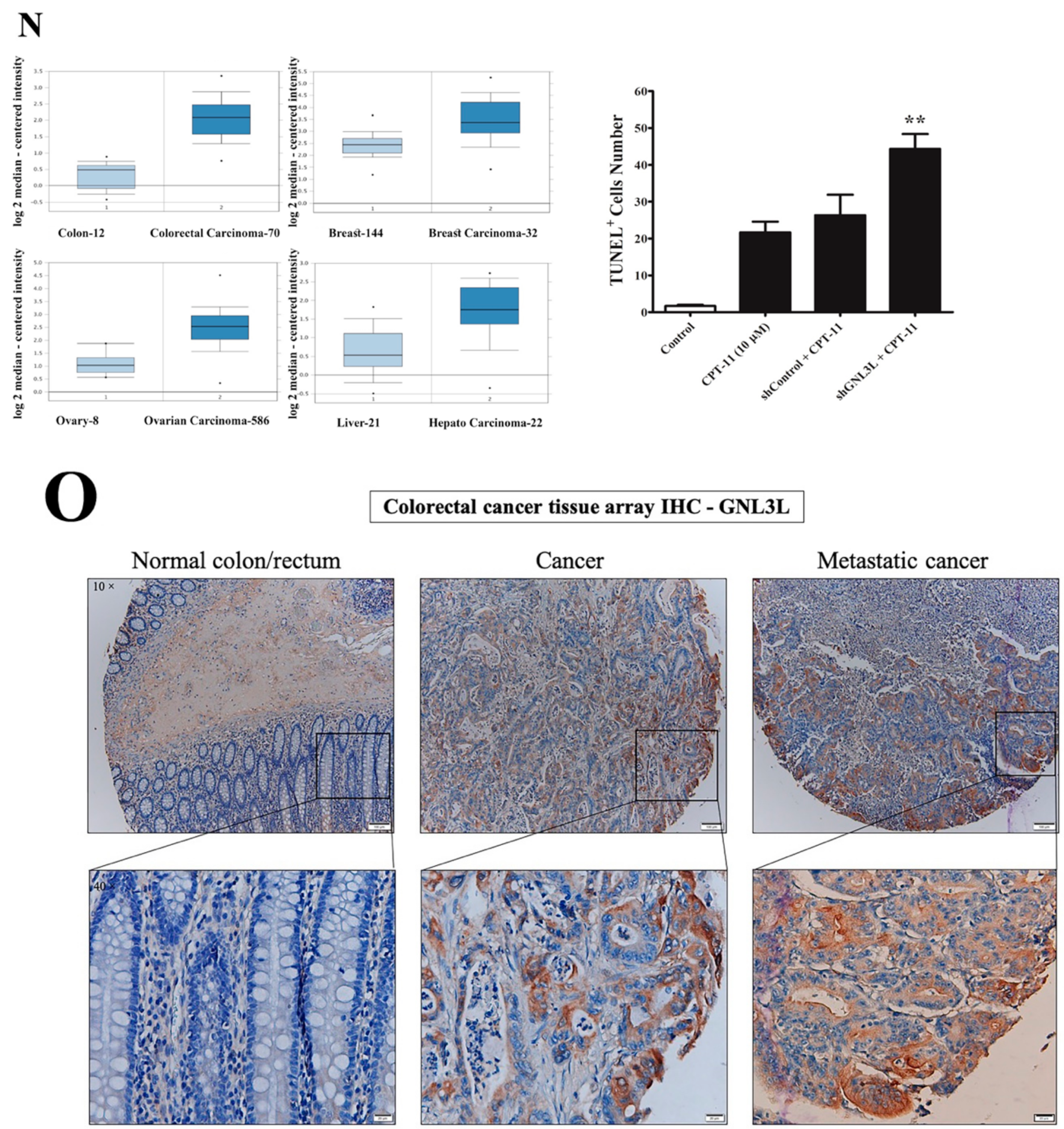 Cancers 12 01231 g007b Cancers 12 01231 g007b