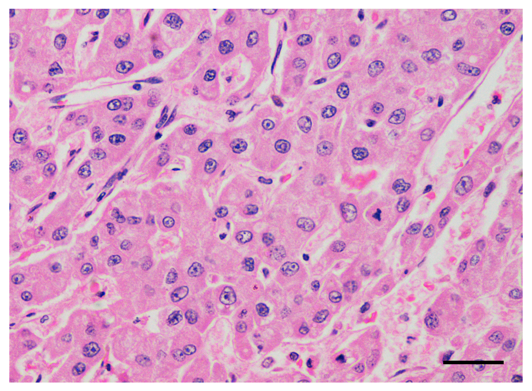 Cancers | Free Full-Text | Sorafenib for the Treatment of Unresectable