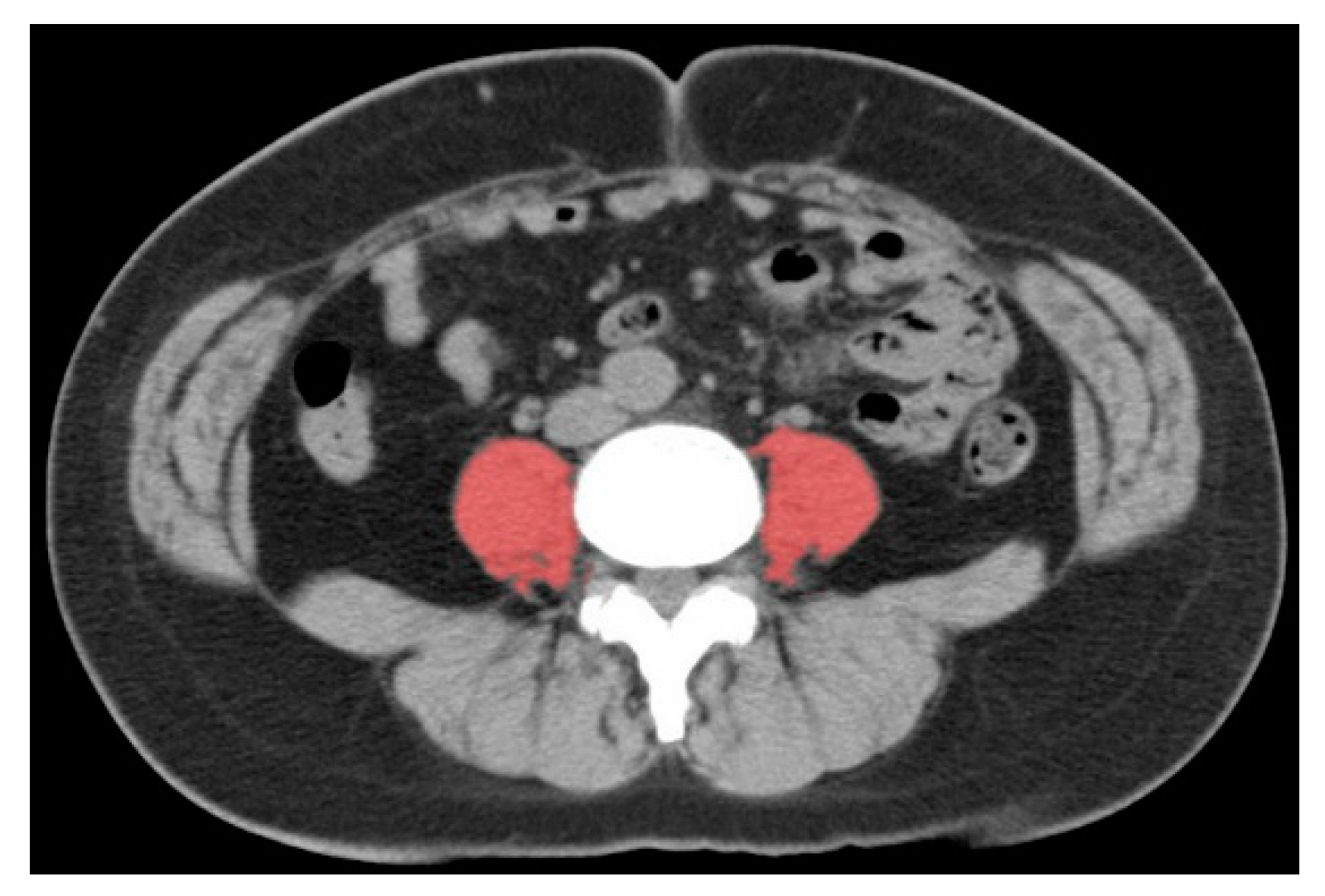 Cancers 12 01465 g002 Cancers 12 01465 g002