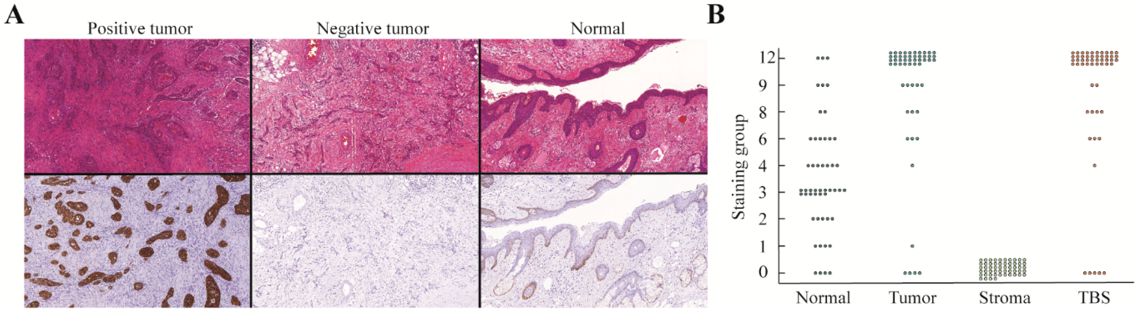 Cancers 12 01474 g002 Cancers 12 01474 g002