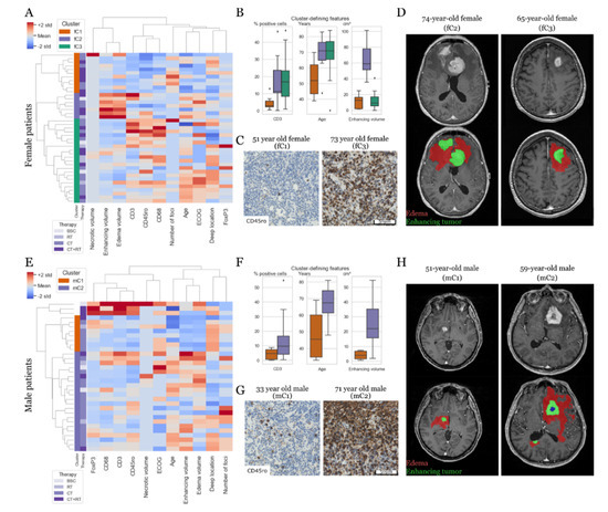 Cancers Free Full Text Sex Specific Differences In Primary Cns Lymphoma 2955