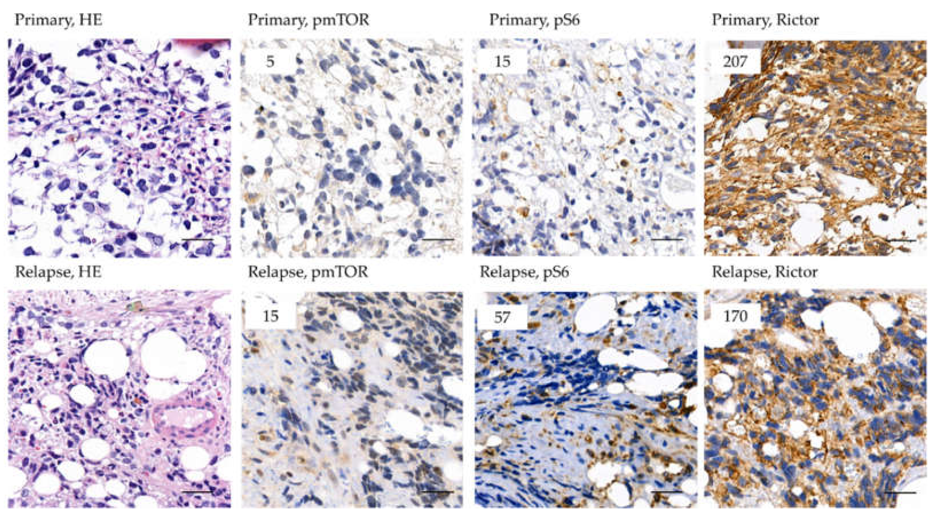 Cancers 12 01947 g007
