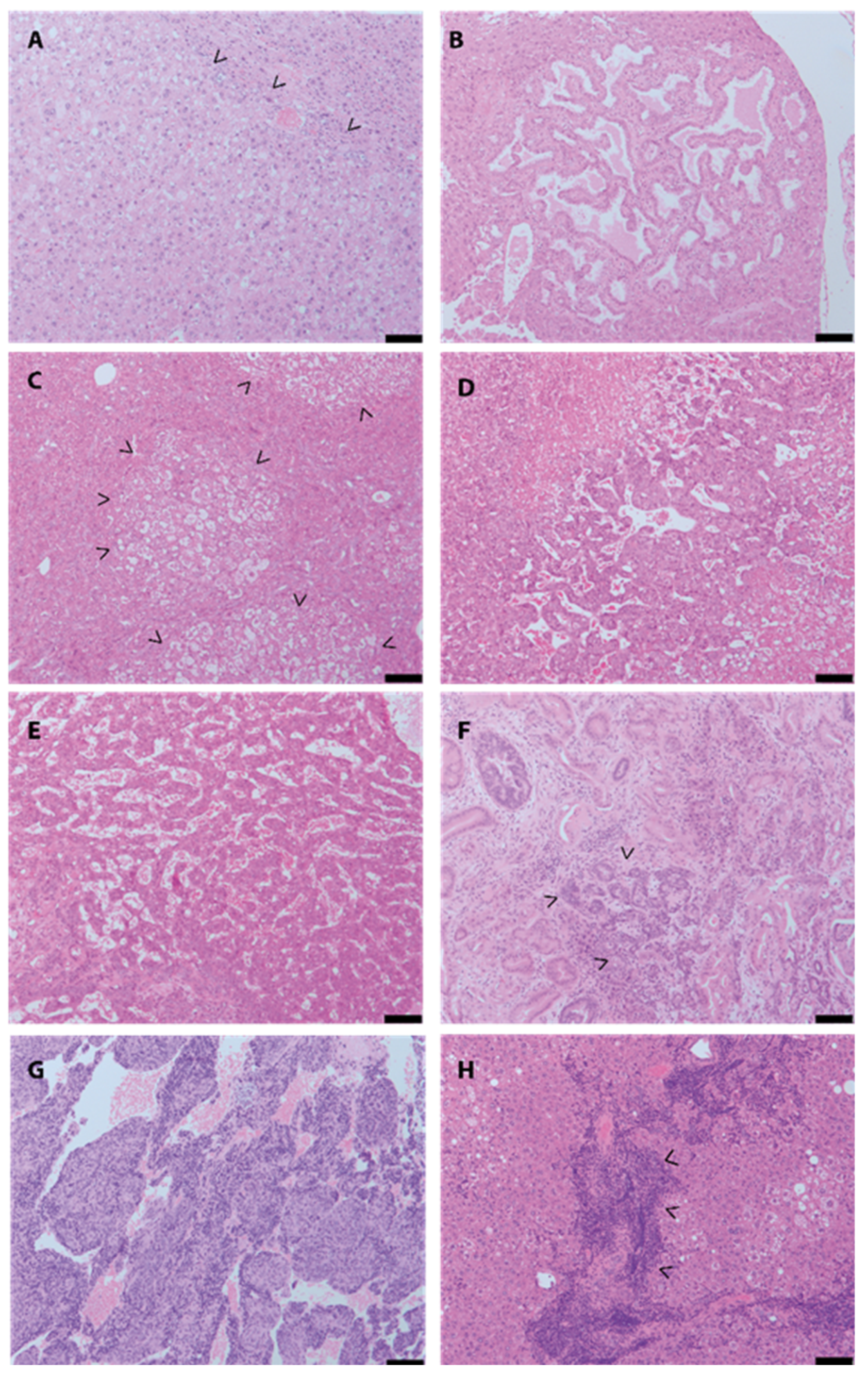 Cancers | Free Full-Text | Genetically Engineered Mouse Models of Liver  Tumorigenesis Reveal a Wide Histological Spectrum of Neoplastic and Non- Neoplastic Liver Lesions