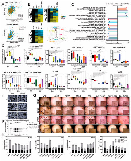 Cancers Free Full Text Combined Targeting Of Estrogen Receptor Alpha And Exportin 1 In Metastatic Breast Cancers Html