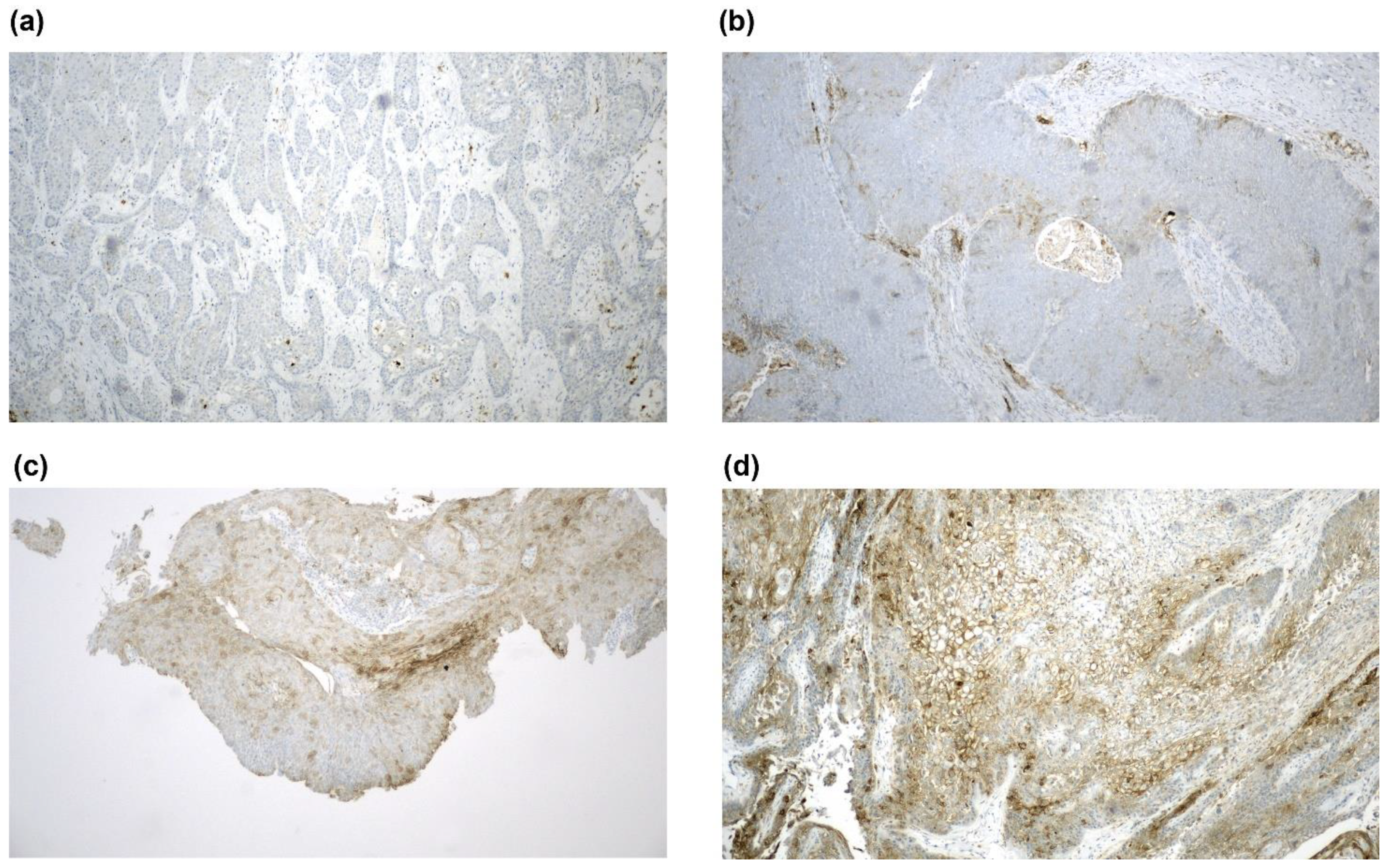 Cancers 12 02516 g003 Cancers 12 02516 g003