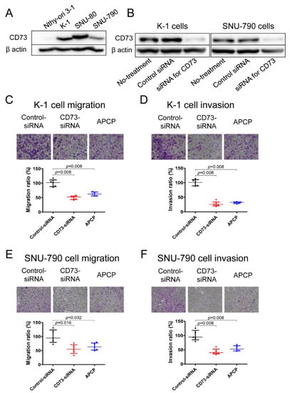 Cancers Free Full Text Cd73 Overexpression Promotes Progression And Recurrence Of Papillary