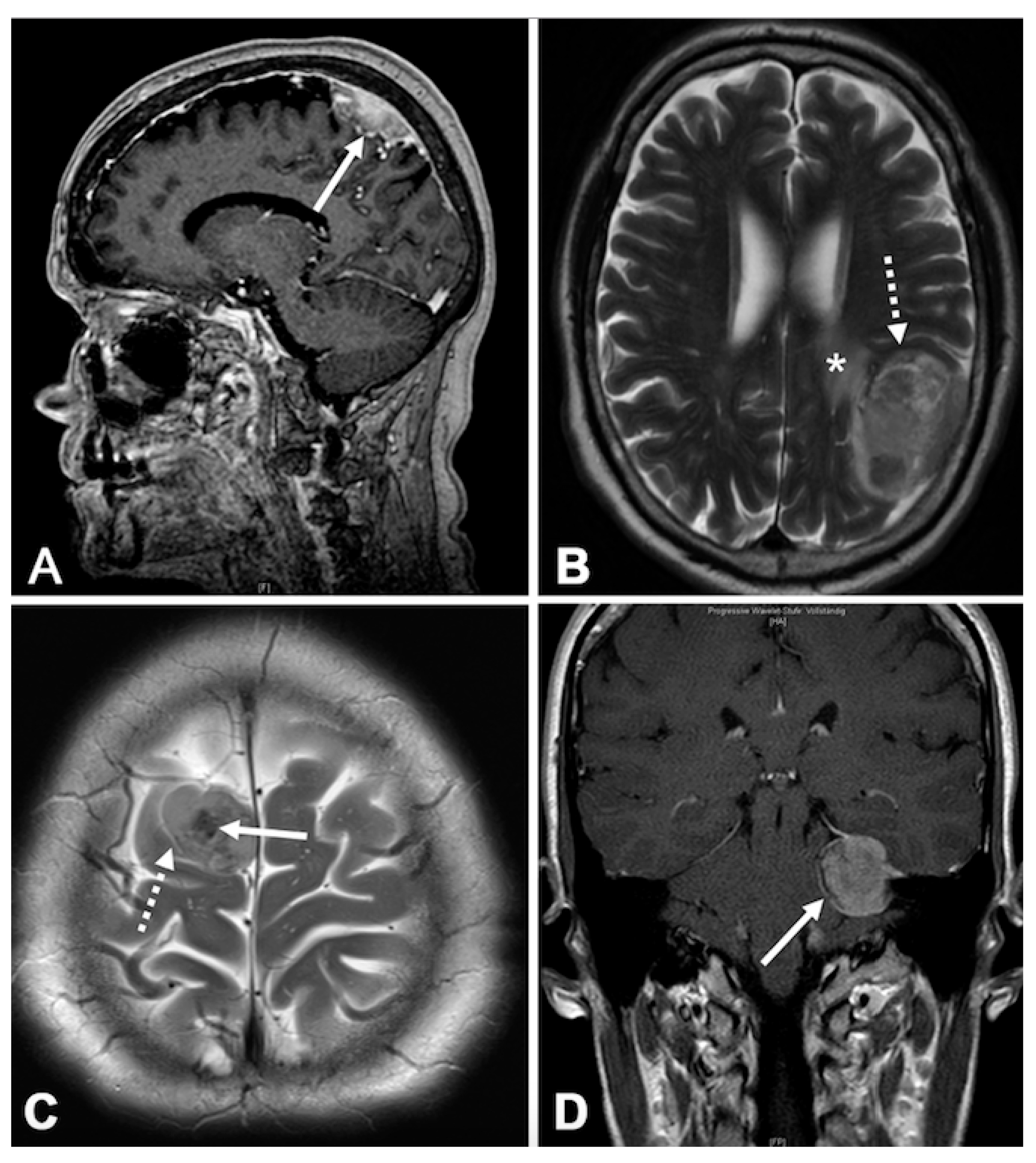 Cancers 12 03075 g004 Cancers 12 03075 g004