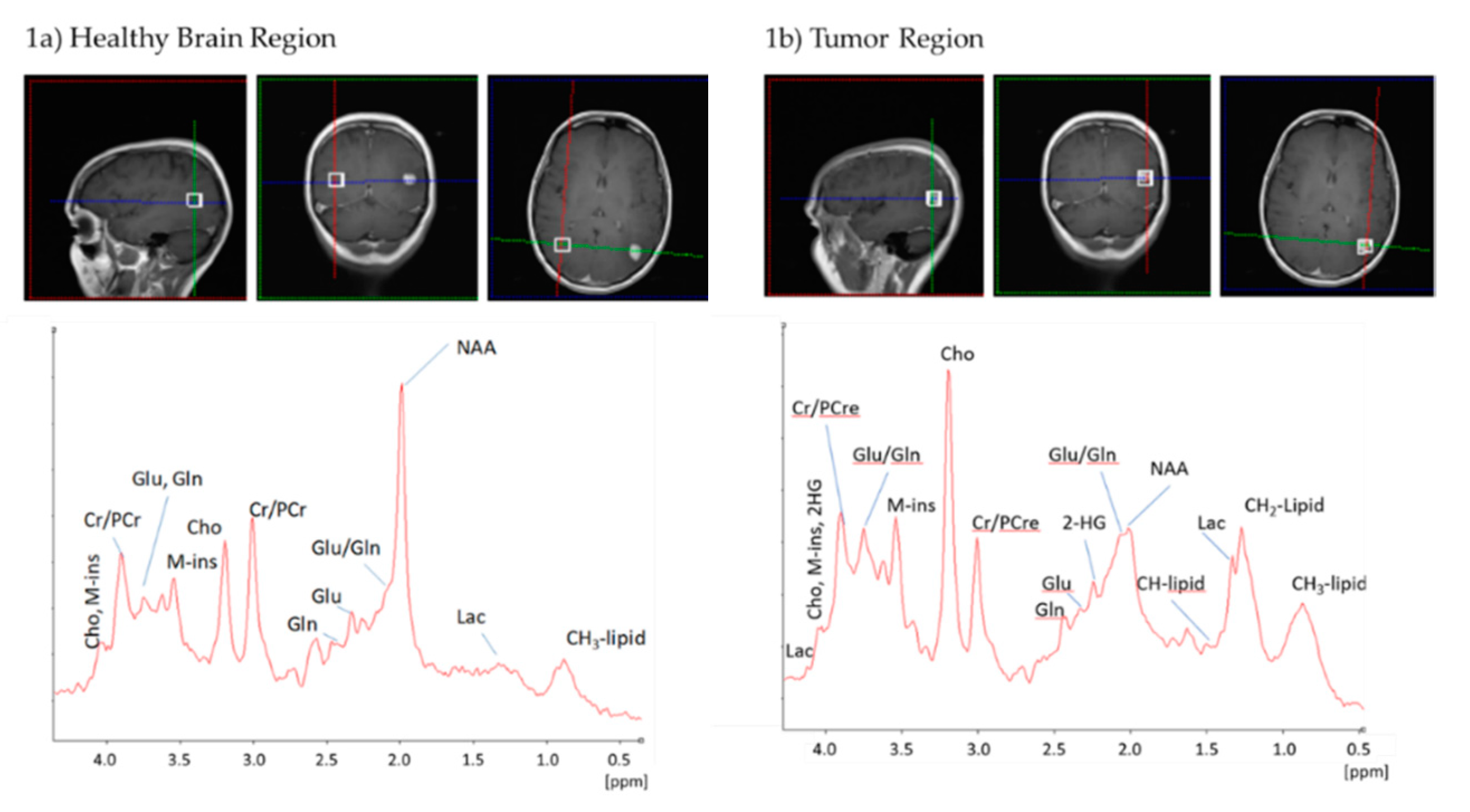 Cancers 12 03406 g001 Cancers 12 03406 g001