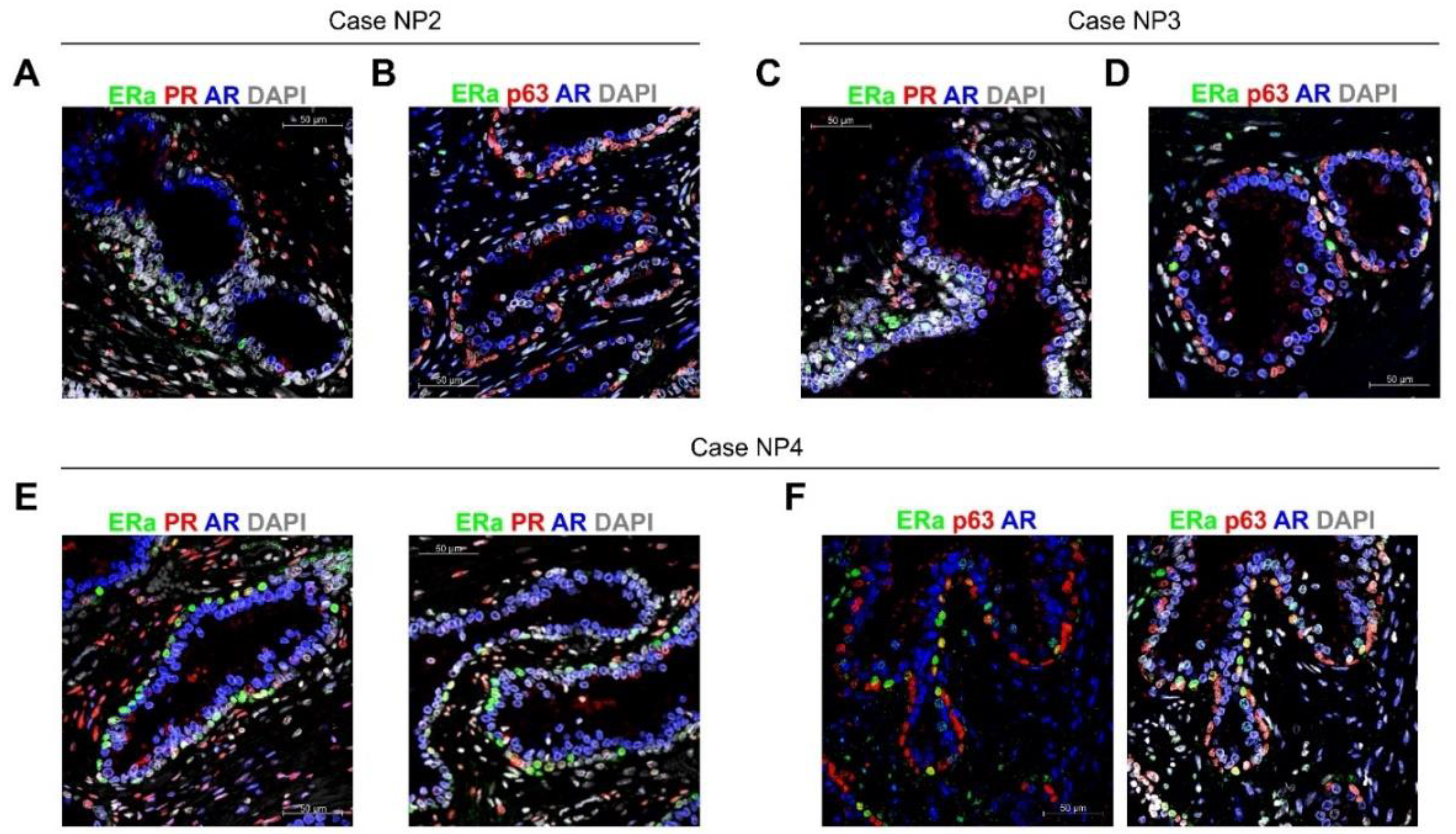Cancers 12 03591 g005a