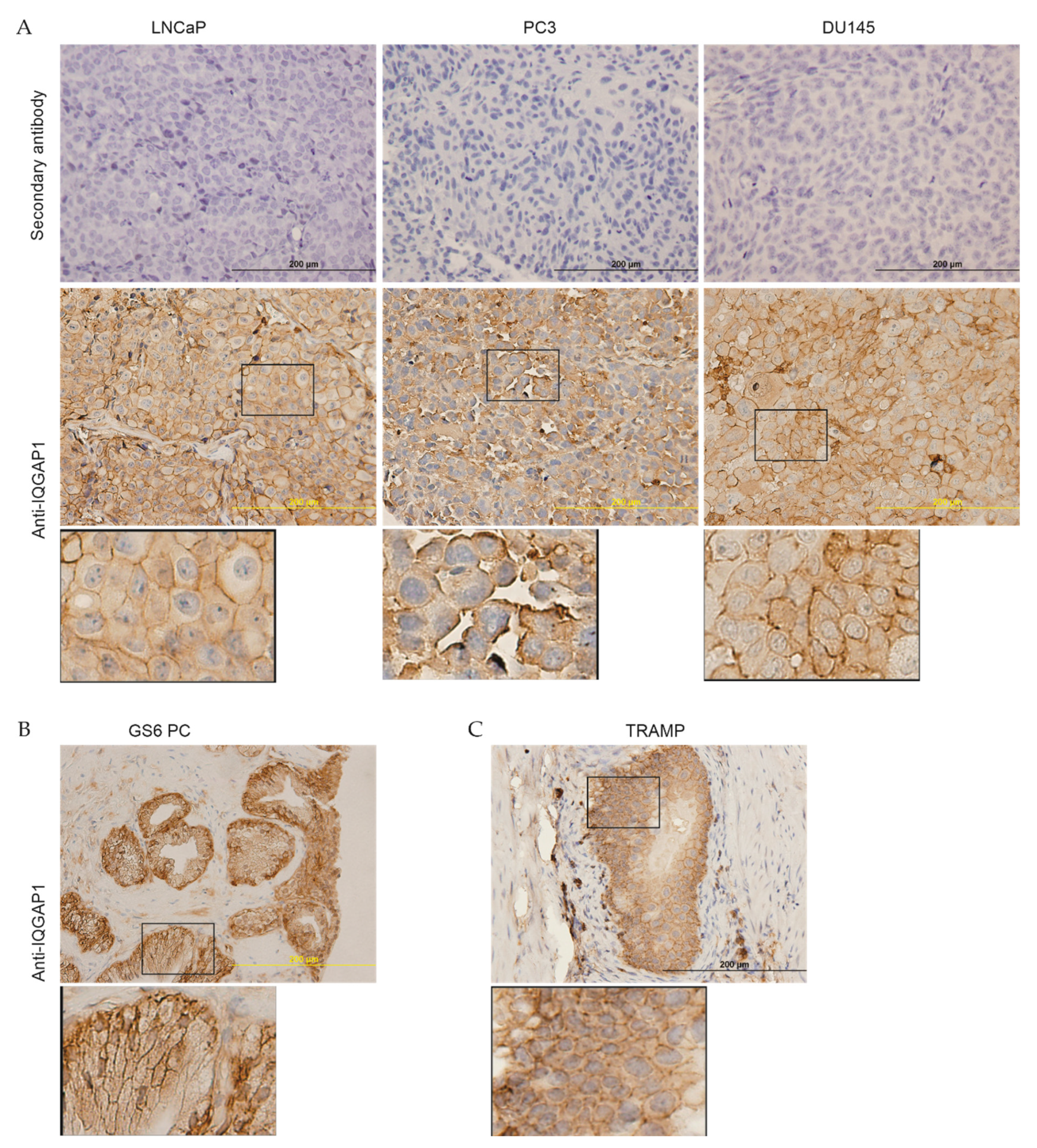 Cancers 13 00430 g003