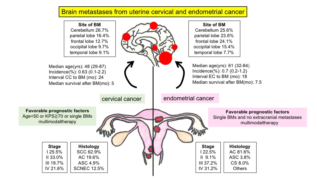 Does Endometrial Cancer Metastasis To Brain