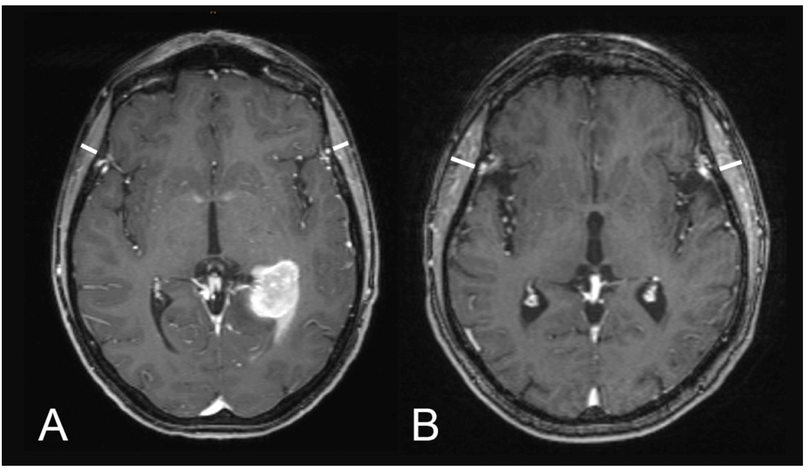 Cancers 13 00566 g001 Cancers 13 00566 g001