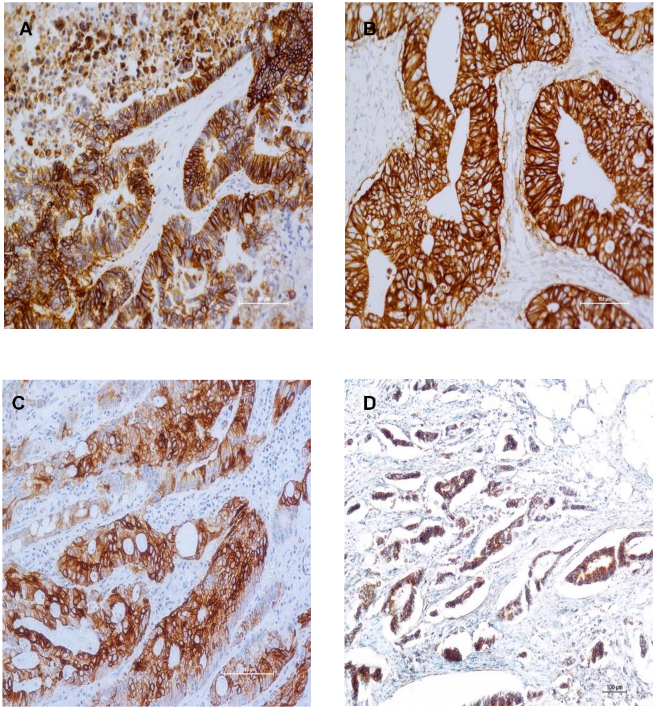 Cancers 13 00638 g001 Cancers 13 00638 g001