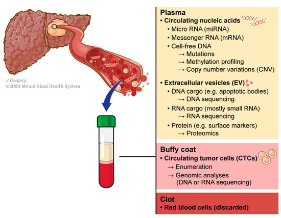Liquid Biopsy In Hepatocellular Carcinoma Encyclopedia Mdpi