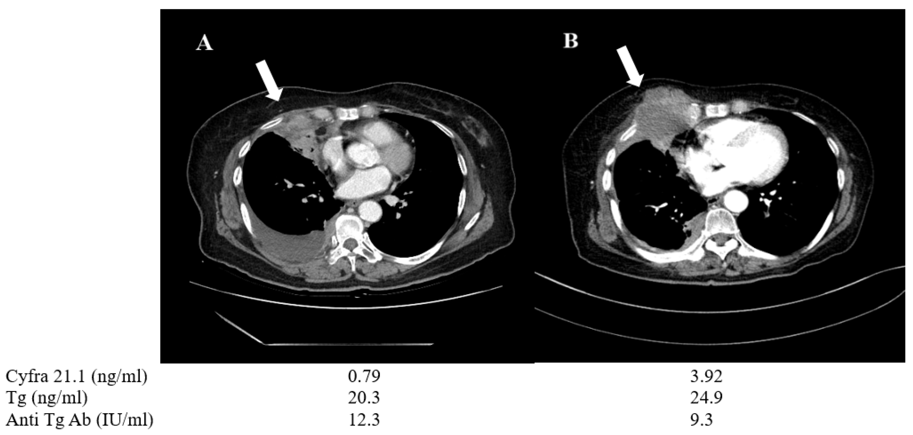 Cancers 13 00811 g006 Cancers 13 00811 g006