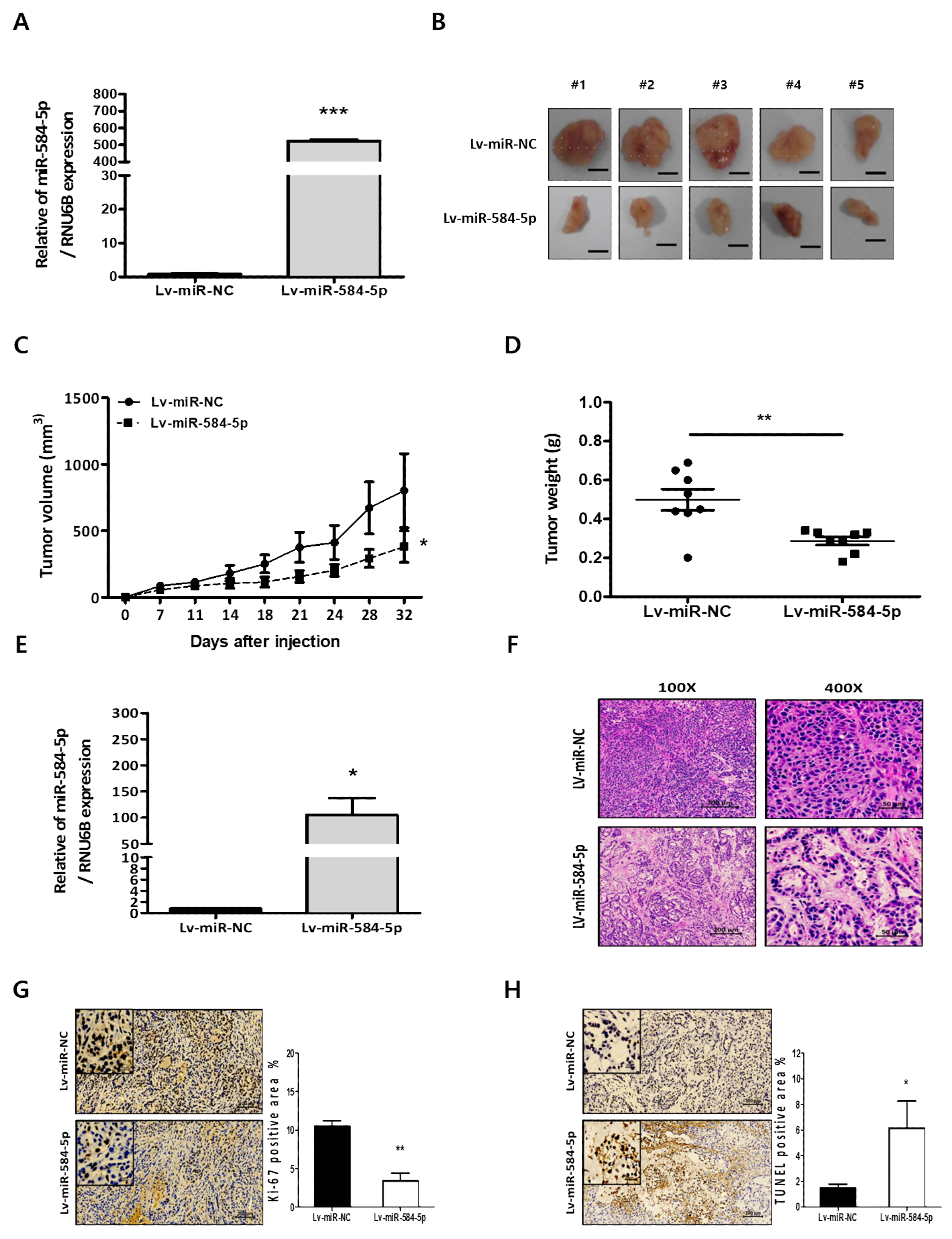 Full article: CircPTCH1 Promotes Migration in Lung Cancer by Regulating  MYCN Expression Through miR-34c-5p