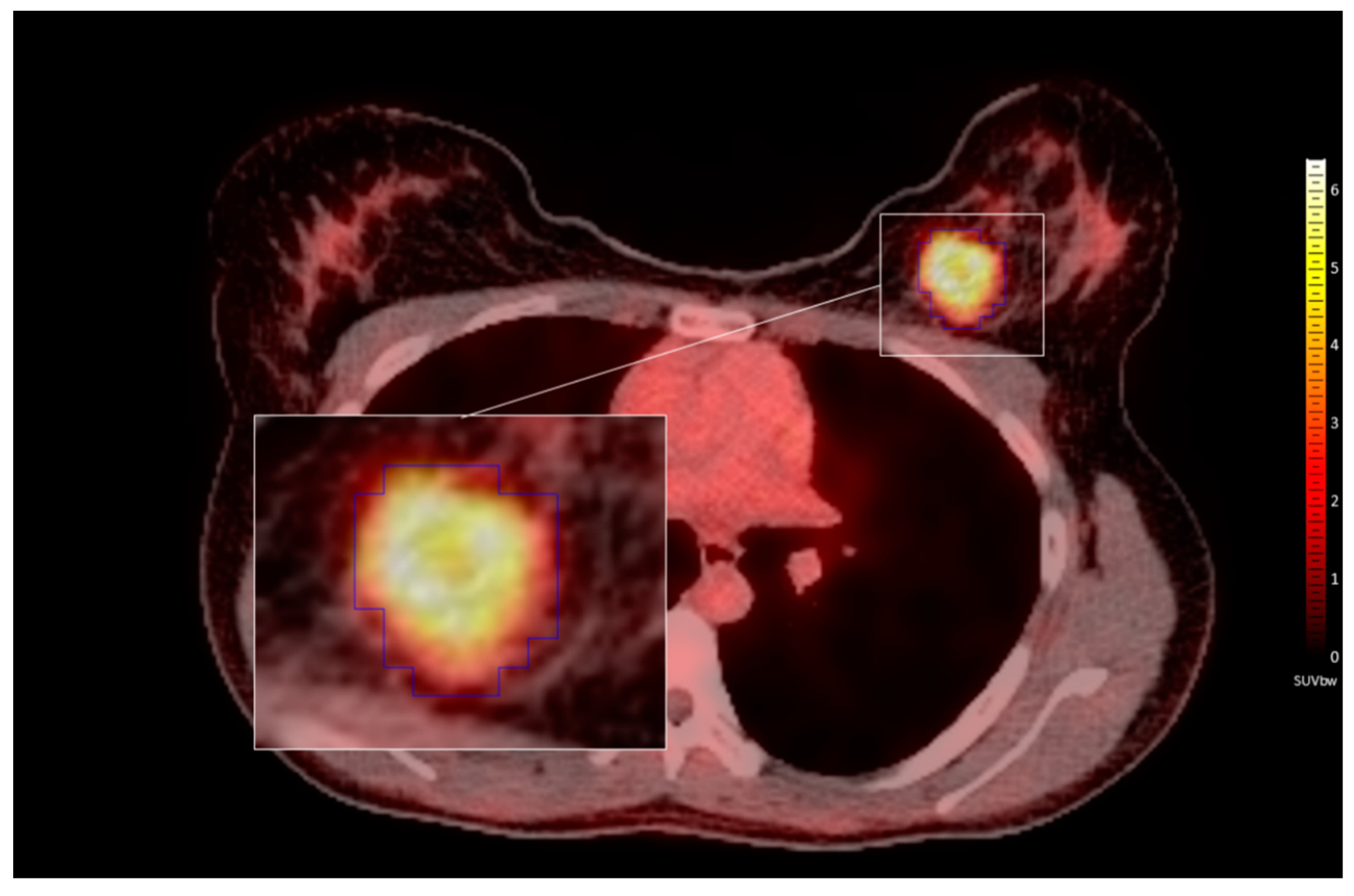 Cancers 13 01249 g002