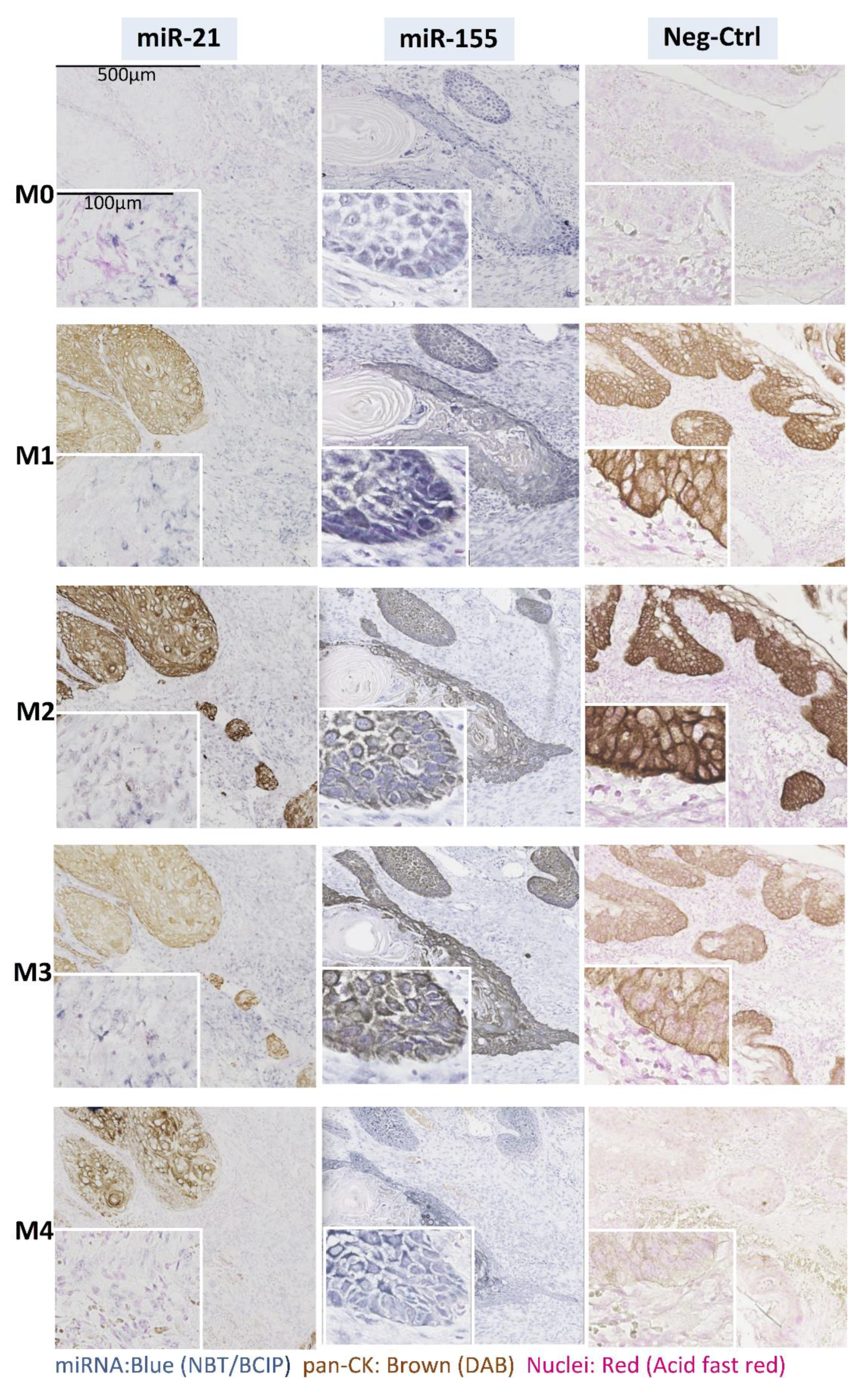 Cancers 13 01307 g003 Cancers 13 01307 g003