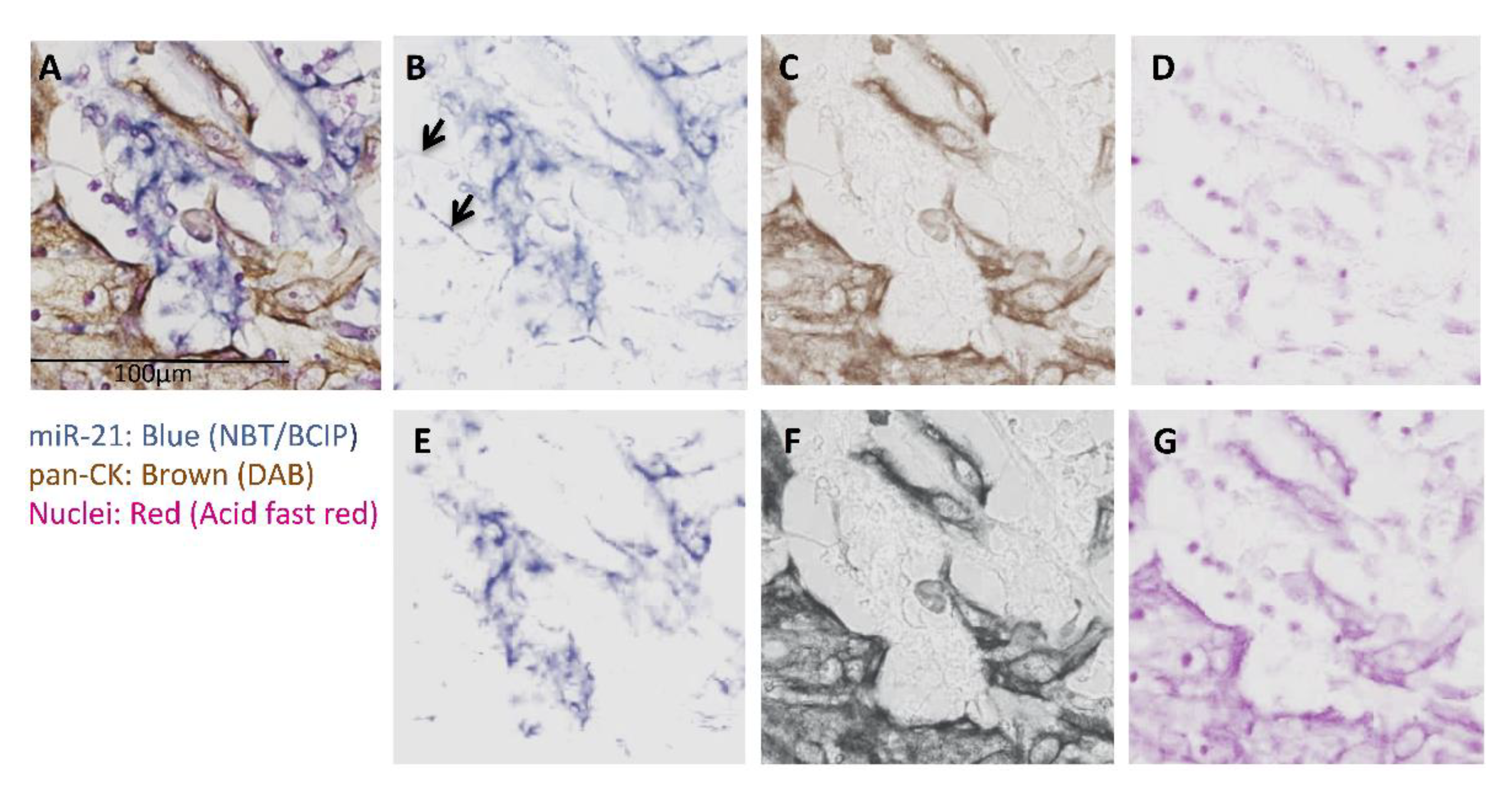 Cancers 13 01307 g005 Cancers 13 01307 g005