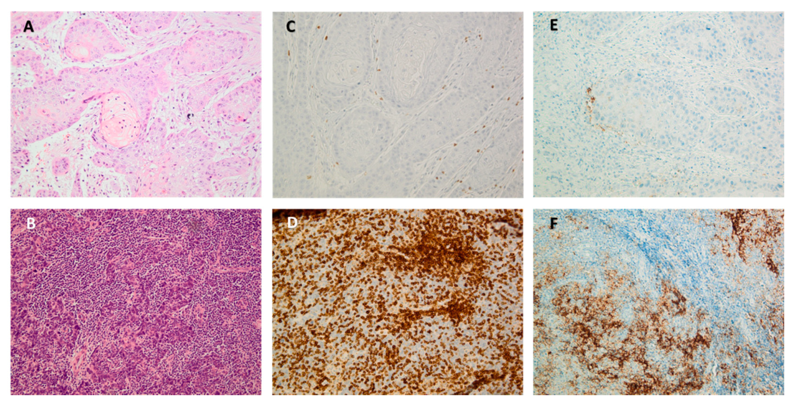 Cancers 13 01714 g002 Cancers 13 01714 g002