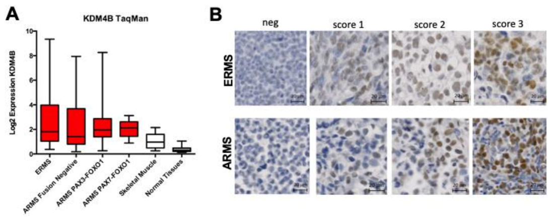 Cancers 13 01734 g002