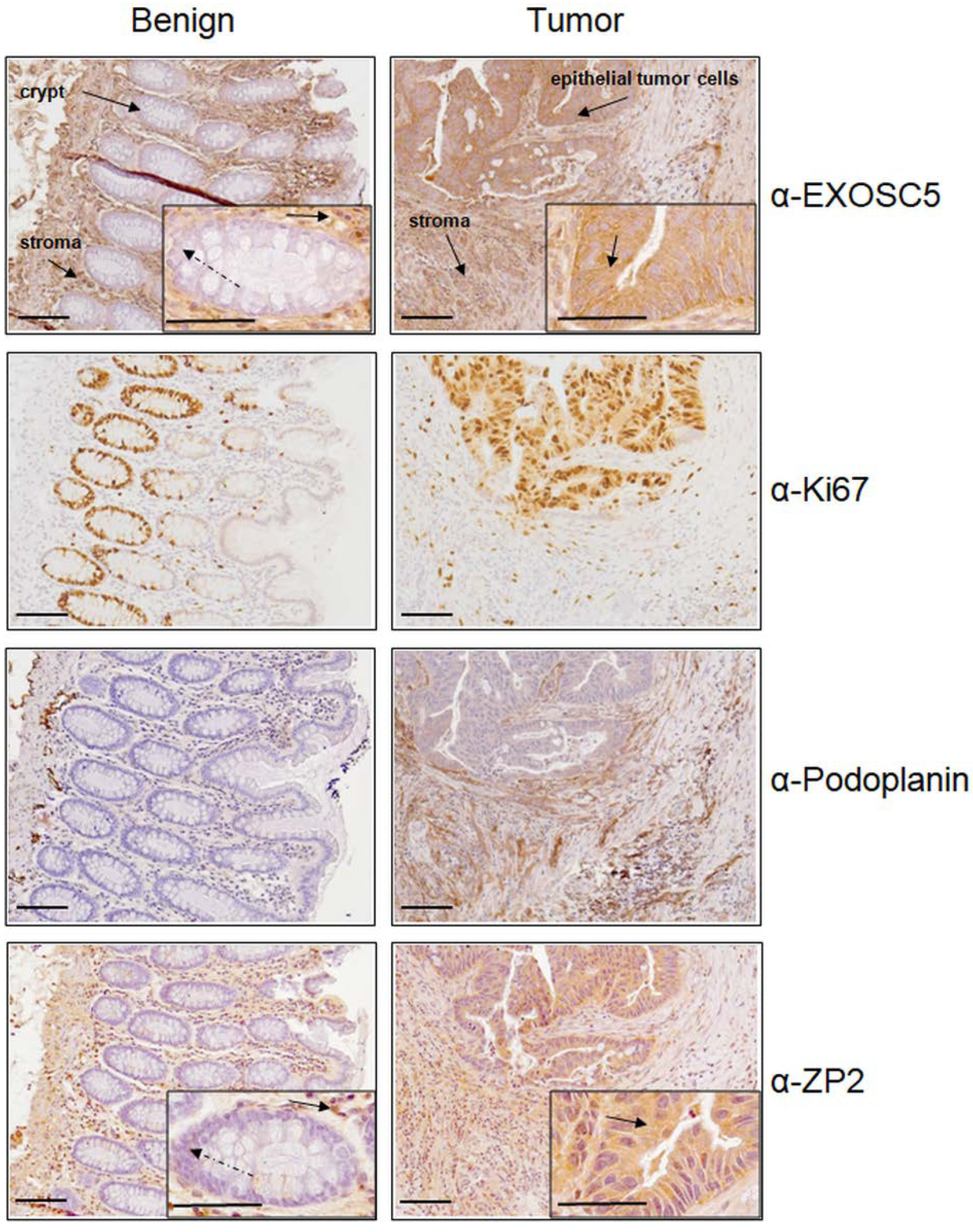 Cancers 13 01759 g005 Cancers 13 01759 g005
