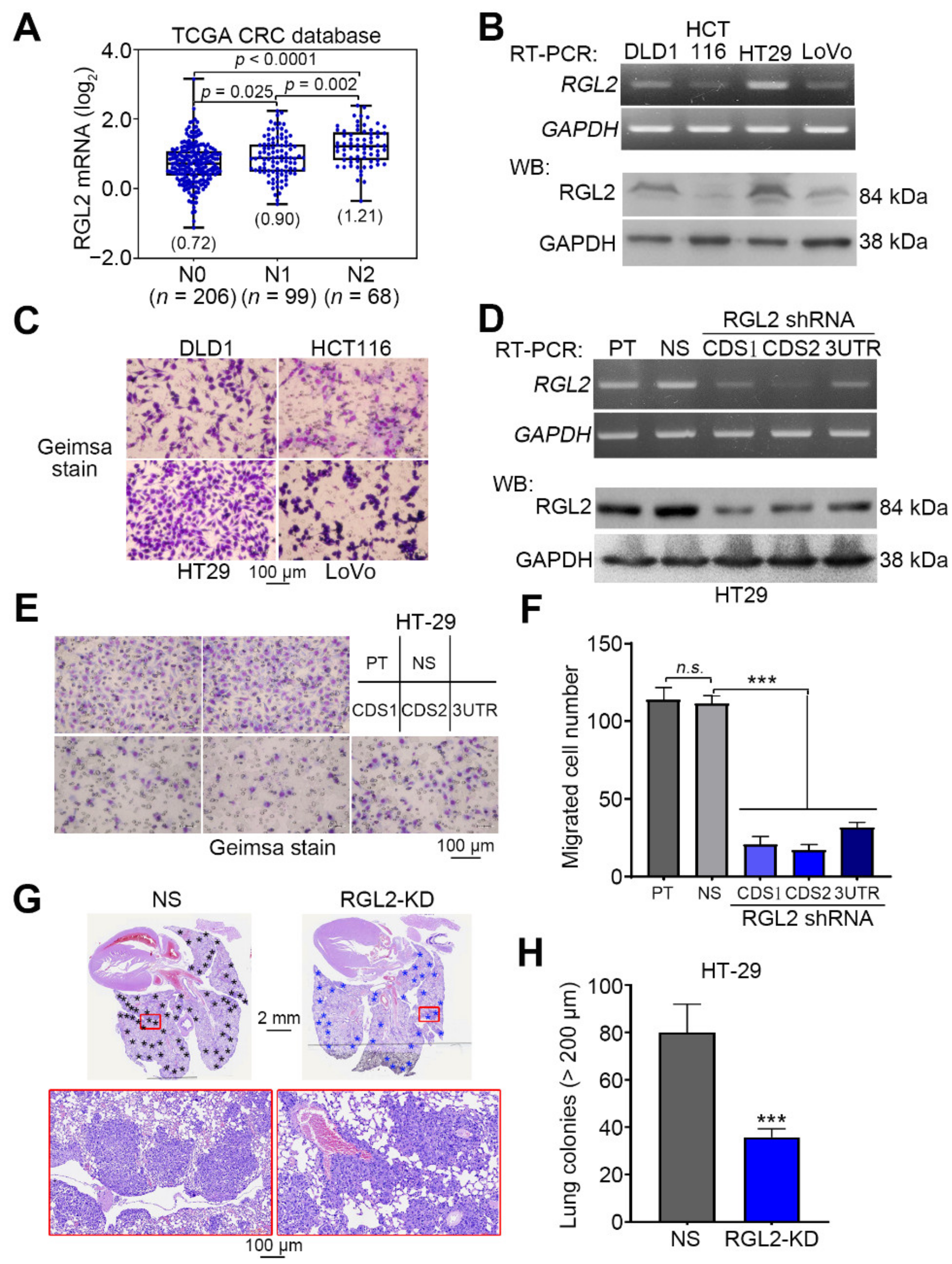 Cancers Free Full Text Rgl2 Drives The Metastatic Progression Of Colorectal Cancer Via Preventing The Protein Degradation Of B Catenin And Kras Html